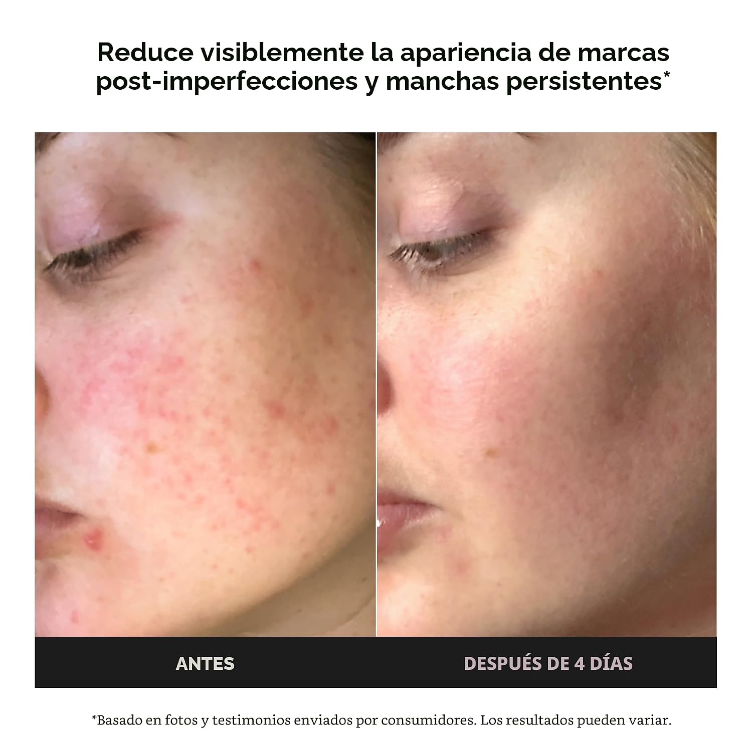 PAULA S CHOICE BOOST - GEL DE CREMA POTENCIADOR DE ÁCIDO AZELAICO AL 10 %, EXTRACTO DE REGALIZ Y ÁCIDO SALICÍLICO, SUERO - 2