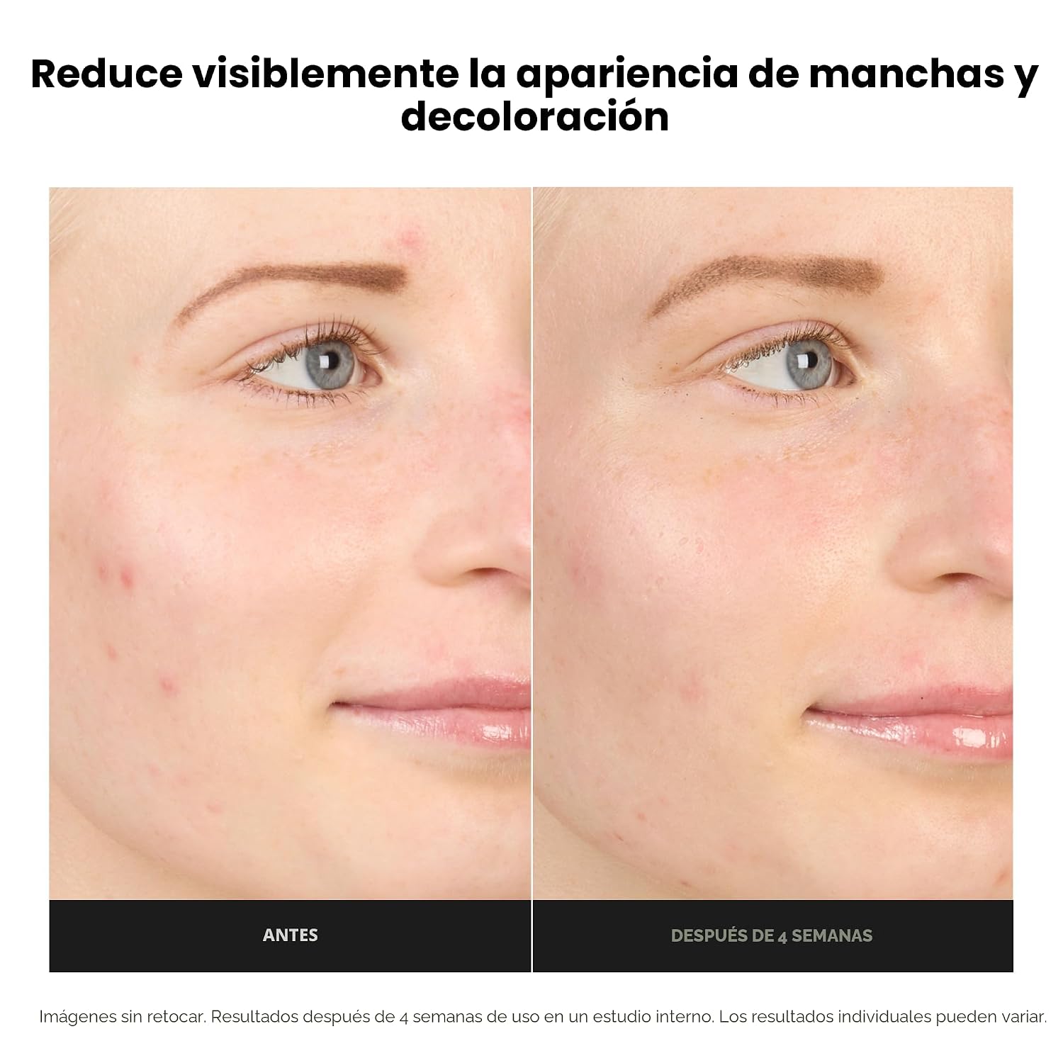 PAULA S CHOICE BOOST - GEL DE CREMA POTENCIADOR DE ÁCIDO AZELAICO AL 10 %, EXTRACTO DE REGALIZ Y ÁCIDO SALICÍLICO, SUERO - 3