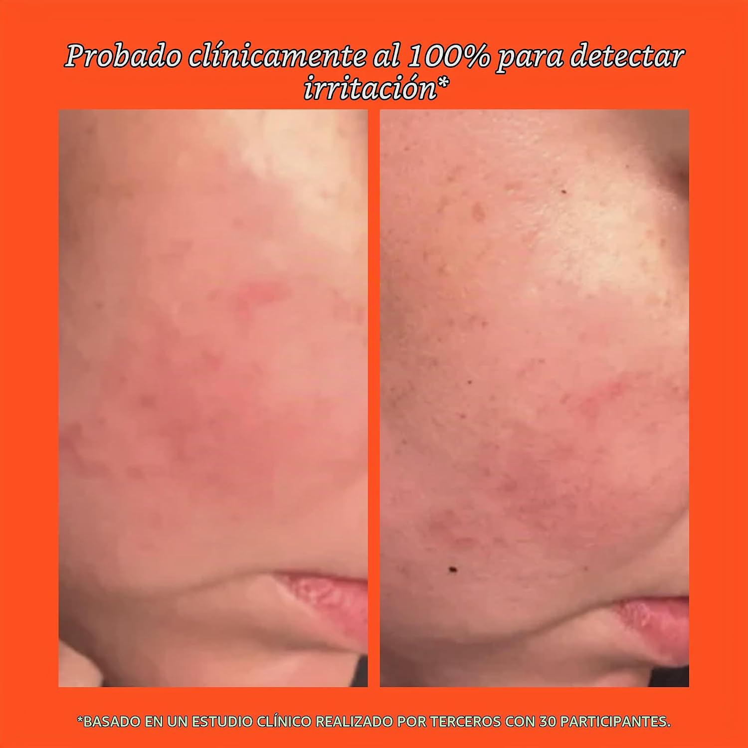 TOWER 28 LIMPIADOR DE GEL SOS REMOVEDOR DE MAQUILLAJE PARA PIEL SENSIBLE, LIMPIADOR FACIAL HIDRATANTE SUAVE EQUILIBRADO - 5