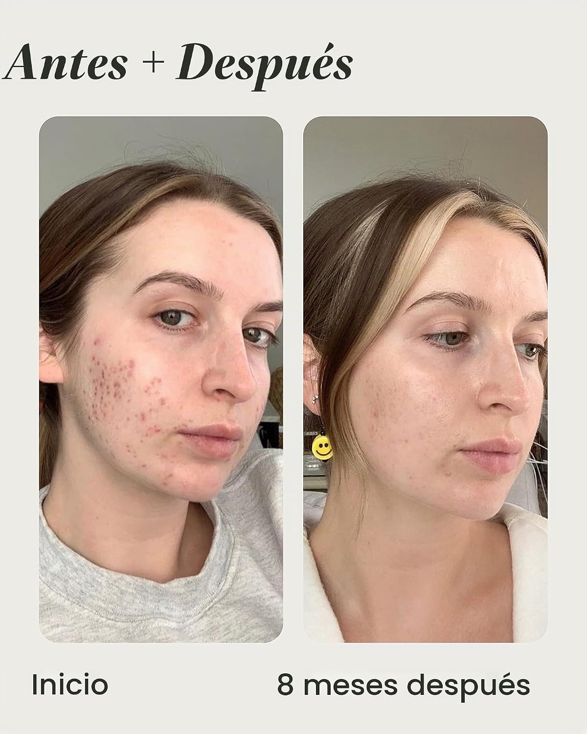 TOPICALS, SUERO ILUMINADOR DESTEÑIDO, REDUCE LA DECOLORACIÓN, 0.5 ONZAS LÍQUIDAS - 5