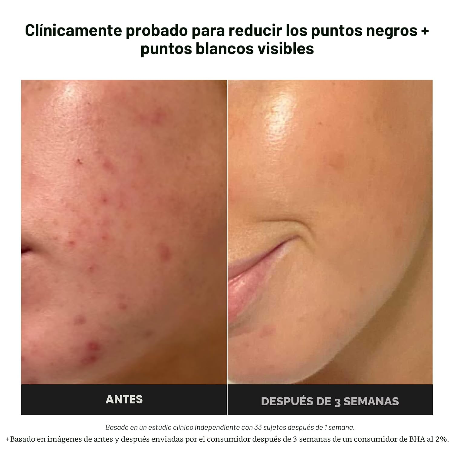 PAULA S CHOICE SKIN PERFECTING 2% BHA SALICYLIC ACID EXFOLIATING PADS - FACIAL EXFOLIANT PADS PARA BLACKHEADS, ENLARGED - 3