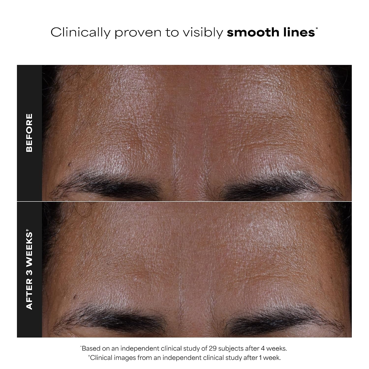 PAULA S CHOICE SKIN PERFECTING 2% BHA SALICYLIC ACID EXFOLIATING PADS - FACIAL EXFOLIANT PADS PARA BLACKHEADS, ENLARGED - 4