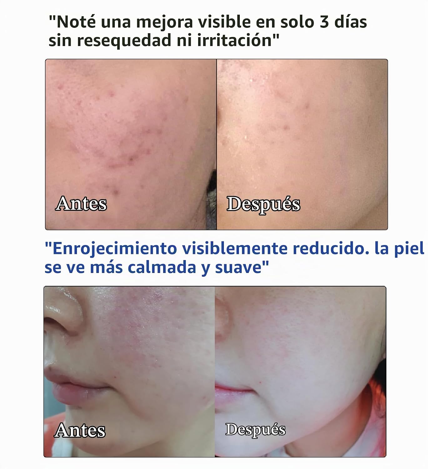 NANO RECIPE CERAMIDE CONCENTRATE DIY CERMIDE SÉRUM FACIAL CONCENTRADO, HIDRATANTE, HIDRATANTE, SIN FRAGANCIA, LIGERO, - 4
