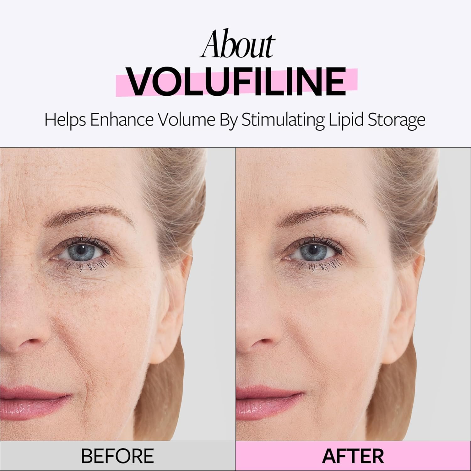 RECIPE VOLUFILINE 100% AMPOLLAS - DE FRANCIA, SEDERMA - SUERO PURO DE VOLUFILINE - IMPULSOR DE CUIDADO DE LA PIEL DIY - 4