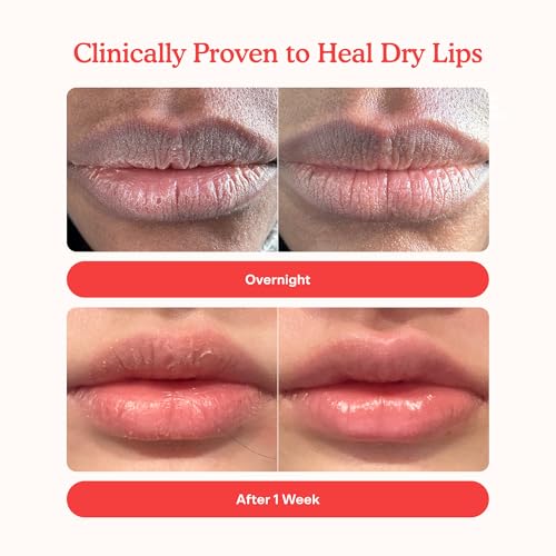TOWER 28 LIPSOFTIE - BĂLSAMO HIDRATANTE PARA TRATAMIENTO DE LABIOS, MASCARILLA HIDRATANTE PARA LABIOS AGRIETADOS, SABOR - 7