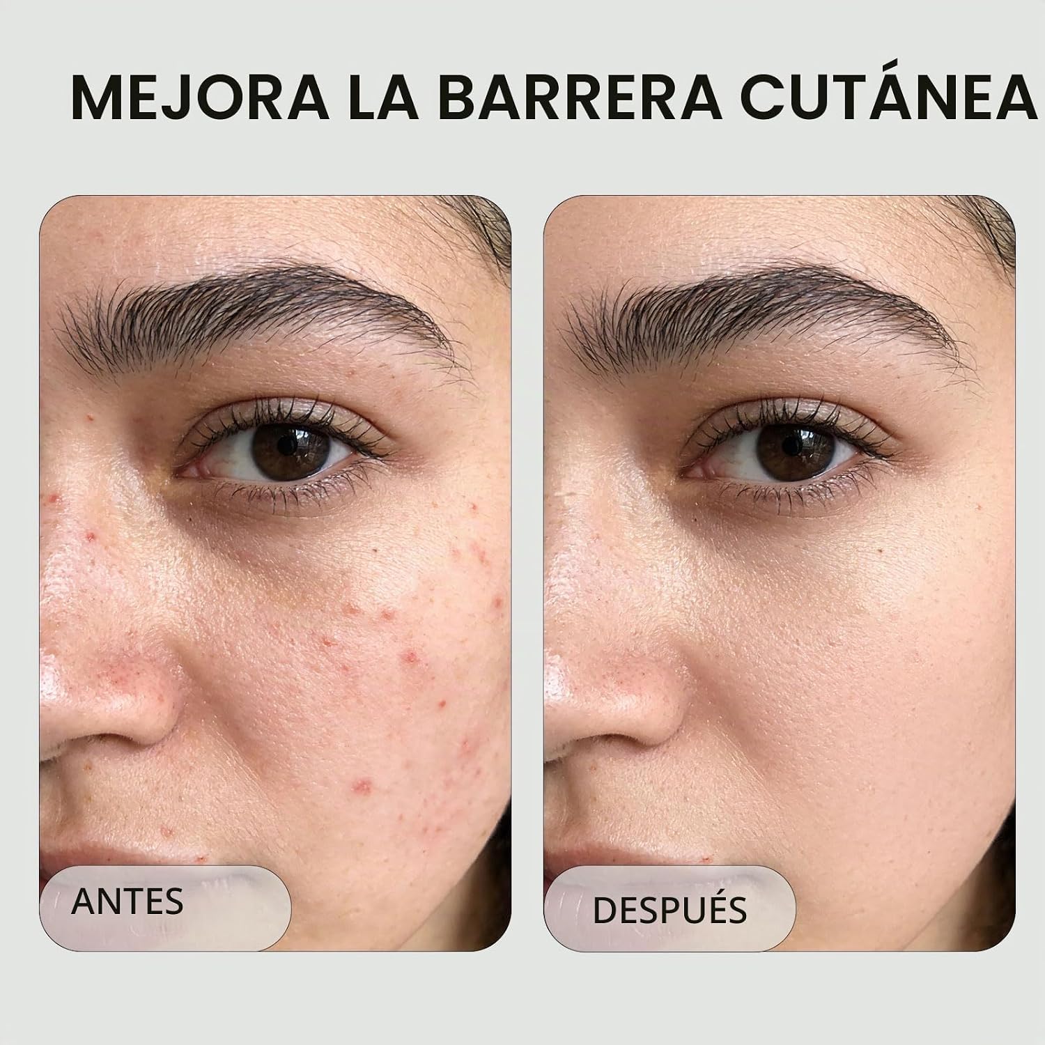 SUERO EXFOLIANTE LÍQUIDO DE ÁCIDO SALICÍLICO BHA 2% PARA ELIMINACIÓN DE PUNTOS NEGROS, DESATASCA LOS POROS, SUAVIZA - 5