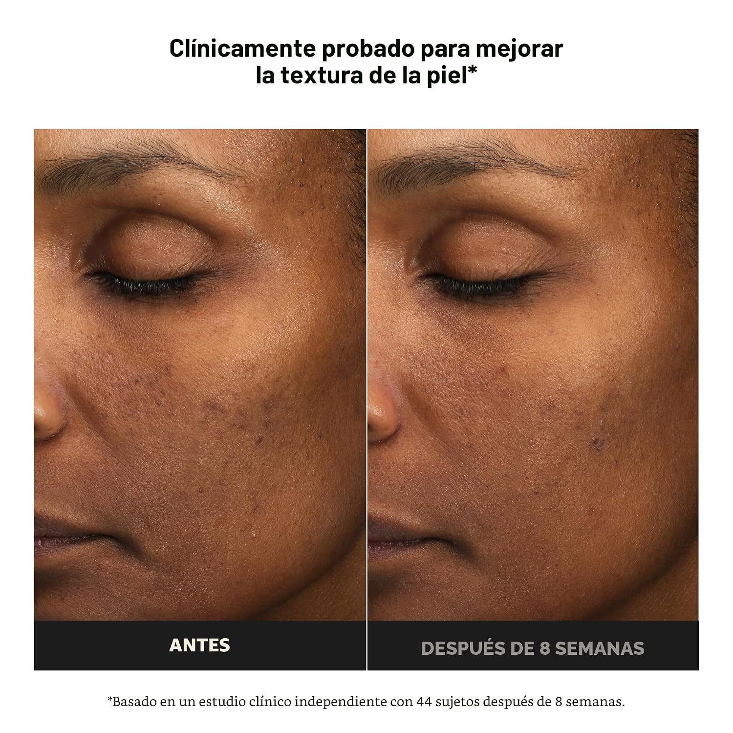 PAULA S CHOICE 6% DE ÁCIDO MANDÉLICO 2% EXFOLIANTE DE ÁCIDO LÁCTICO, EXFOLIANTE DIARIO SUAVE AHA PARA DECOLORACIÓN, TEXTURA - 3