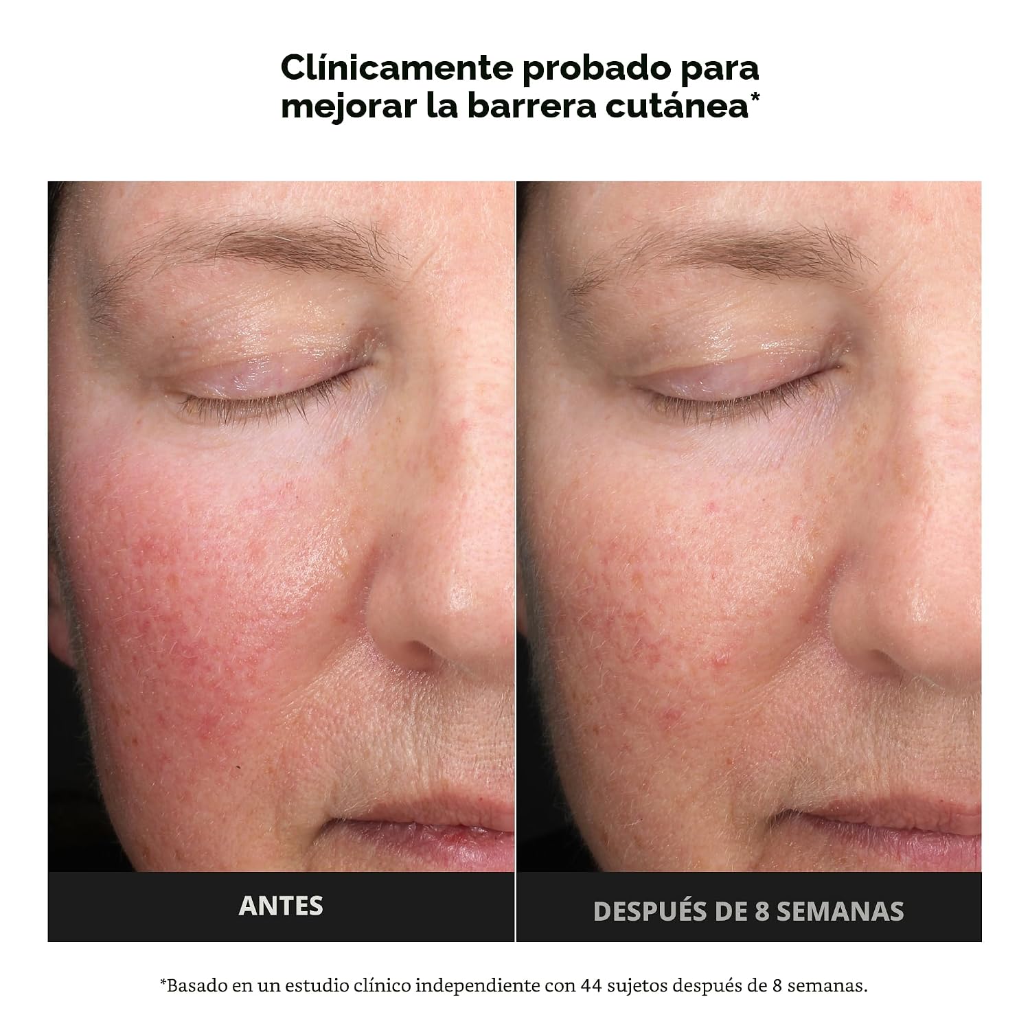 PAULA S CHOICE 6% DE ÁCIDO MANDÉLICO 2% EXFOLIANTE DE ÁCIDO LÁCTICO, EXFOLIANTE DIARIO SUAVE AHA PARA DECOLORACIÓN, TEXTURA - 4