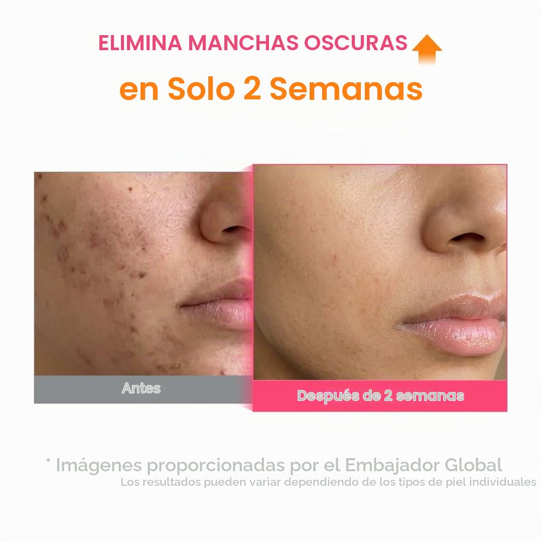 PURITO TXA 6% NIACINAMIDA 10% RETINAL SUERO FACIAL PARA MANCHAS OSCURAS, HIPERPIGMENTACIÓN, TONO DESIGUAL ÁCIDO TRANEXÁMICO - 4