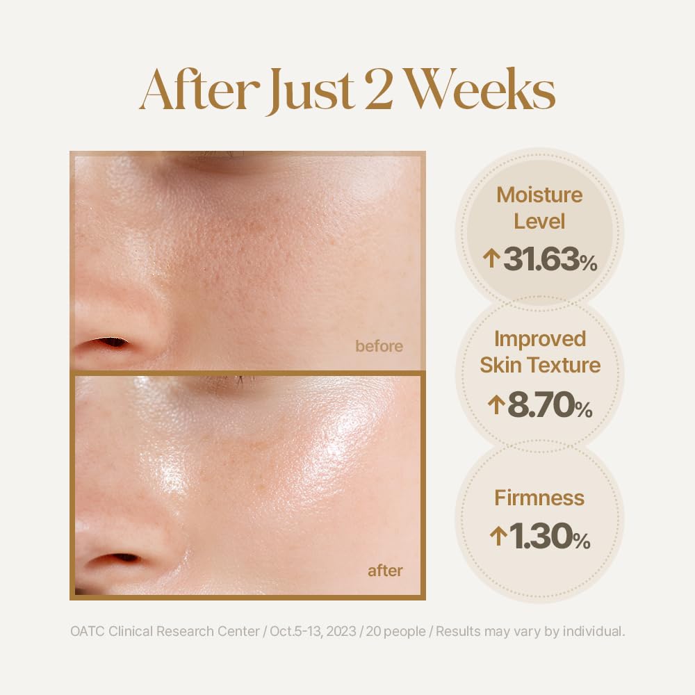 TRIPLE ACTIVE MIST, SUERO COREANO PARA EL CUIDADO DE LA PIEL, TRATAMIENTO FACIAL HIDRATANTE TODO EN UNO PARA PIEL RADIANTE - 3