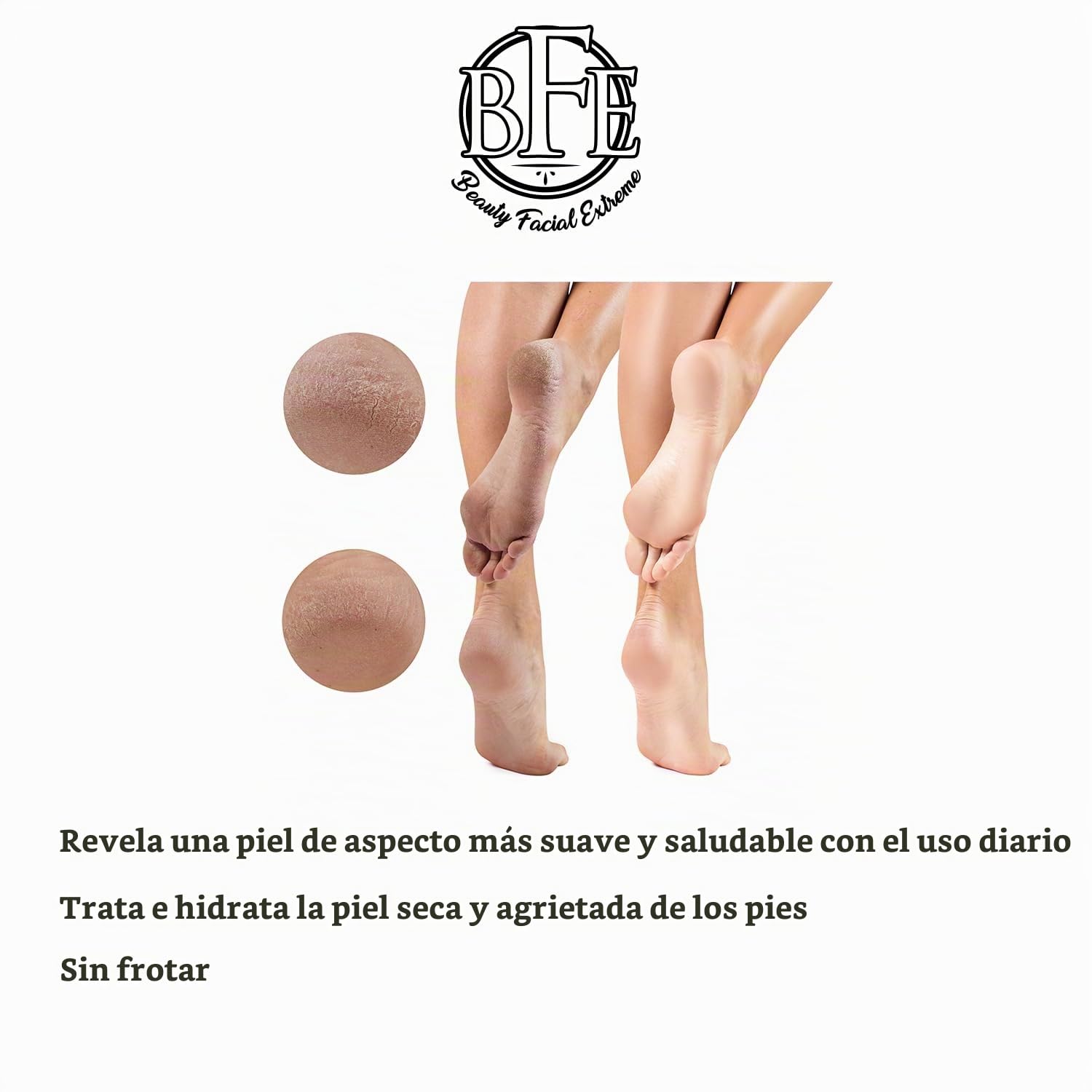 LOCIÓN CORPORAL EXFOLIANTE KERATOSIS PILARIS - 12% DE ÁCIDO LÁCTICO. PROPORCIONA HUMEDAD INMEDIATA Y EXFOLIACIÓN SUAVE - 6
