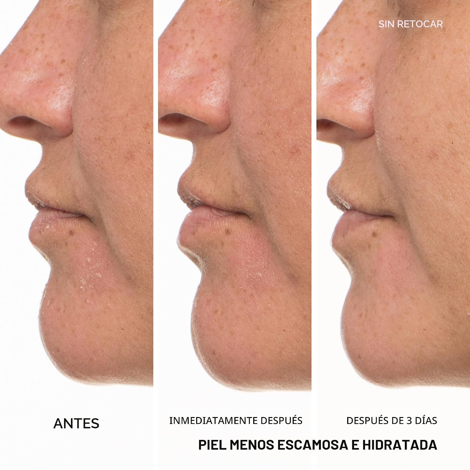 INNISFREE GREEN TEA CERAMIDE MILK HIDRATANTE FACIAL Y LIGHTWEIGHT KOREAN MILKY TÓNICO FACIAL PARA BARRIER REPAIR SUITABLE - 5