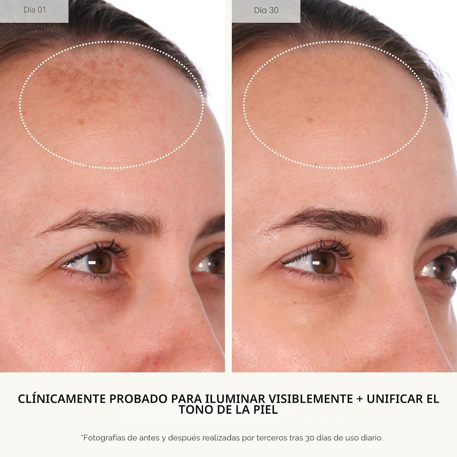 U BEAUTY COMPUESTO REJUVENECEDOR: SUERO DIARIO ANTIENVEJECIMIENTO CON ÁCIDO MANDÉLICO, UNA SUAVE MEZCLA DE EXFOLIANTES, - 4