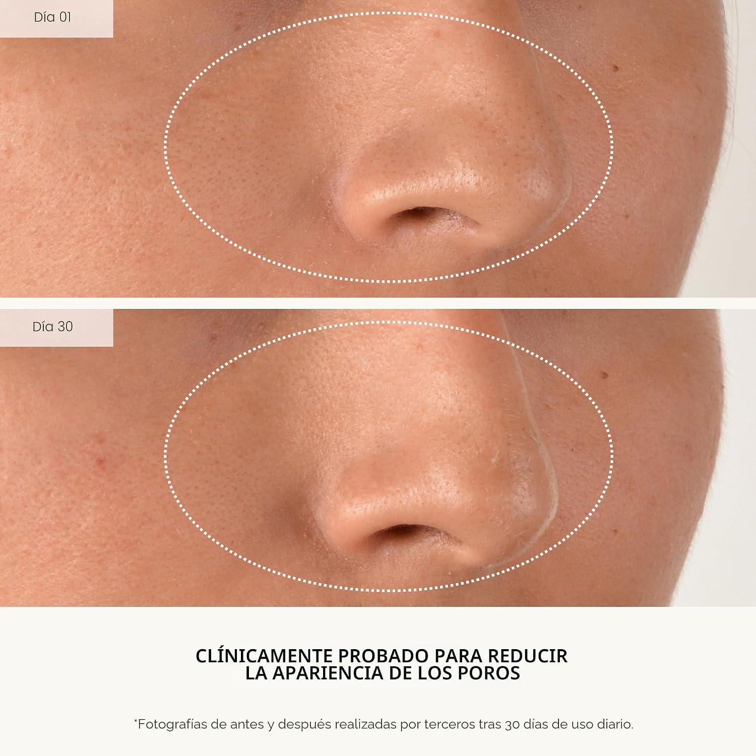 U BEAUTY COMPUESTO REJUVENECEDOR: SUERO DIARIO ANTIENVEJECIMIENTO CON ÁCIDO MANDÉLICO, UNA SUAVE MEZCLA DE EXFOLIANTES, - 5