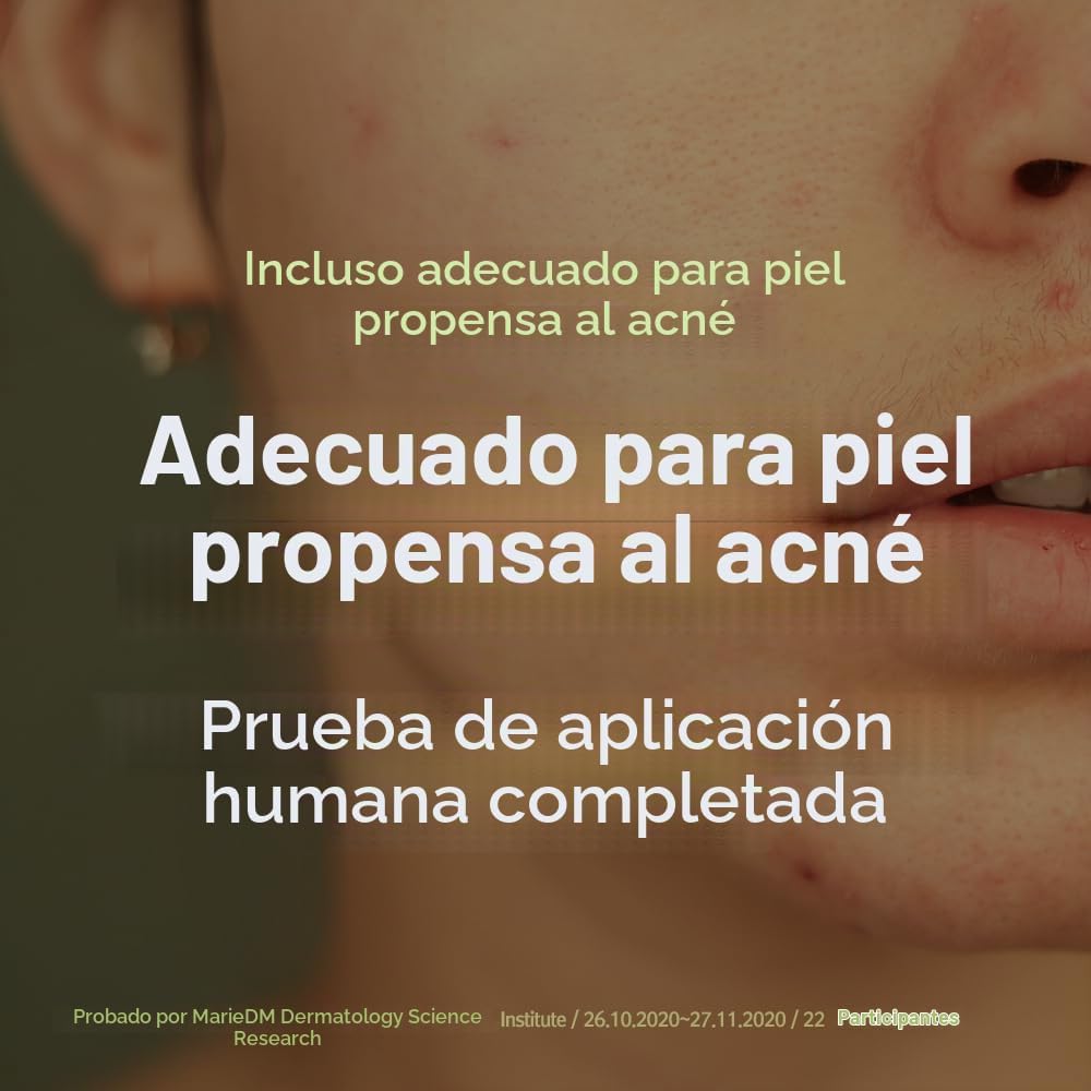 PYUNKANG YUL PKY - TÓNICO CALMANTE DE HUMEDAD PROFUNDA PARA EL ROSTRO - TÓNICO FACIAL PARA MUJERES CON AHA Y PHA - - 3