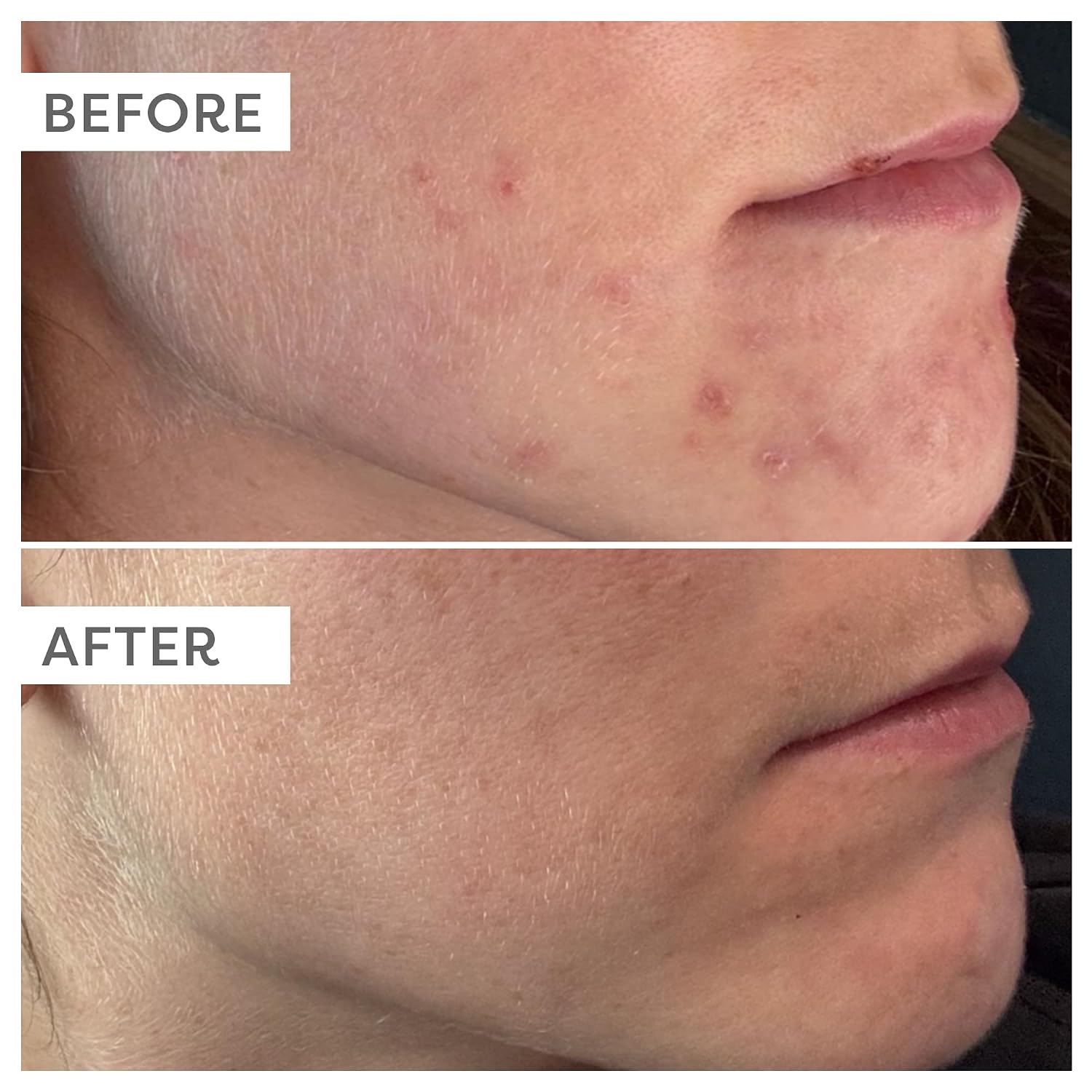 TRUSKIN - SUERO FACIAL CON VITAMINA C, SUERO FACIAL ANTIENVEJECIMIENTO CON VITAMINA C, ÁCIDO HIALURÓNICO, VITAMINA E Y MÁS, - 4