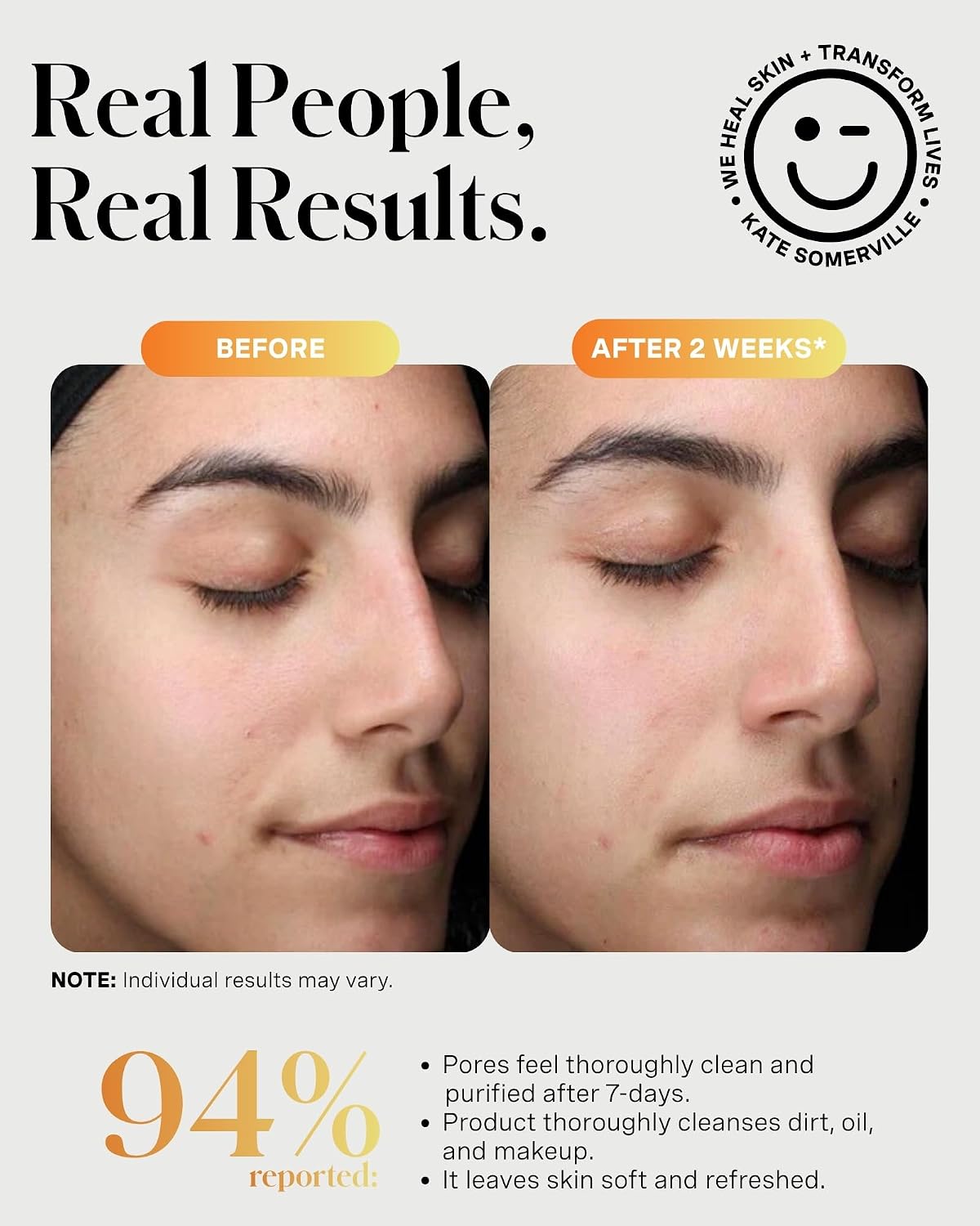 KATE SOMERVILLE EXFOLIKATE LIMPIADOR LAVADO FACIAL EXFOLIANTE ESPUMANTE DIARIO EXFOLIANTE FACIAL SUAVE CON ĂCIDO GLICĂLICO - 6