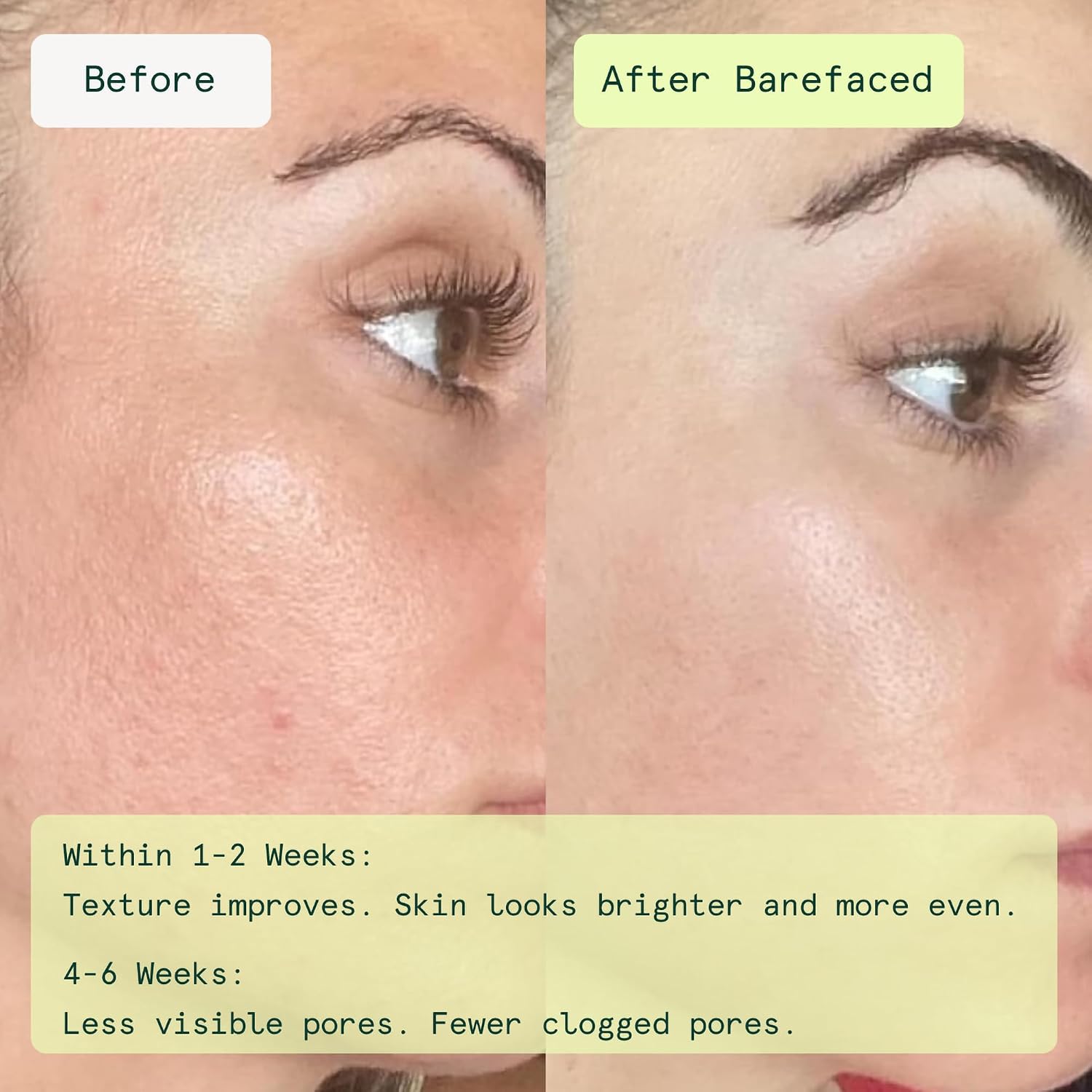 BAREFACED ALMOHADILLAS TONIFICANTES Y EXFOLIANTES TOALLITAS FACIALES DE ÁCIDO GLICÓLICO Y SALICÍLICO PARA MANCHAS, MANCHAS - 2