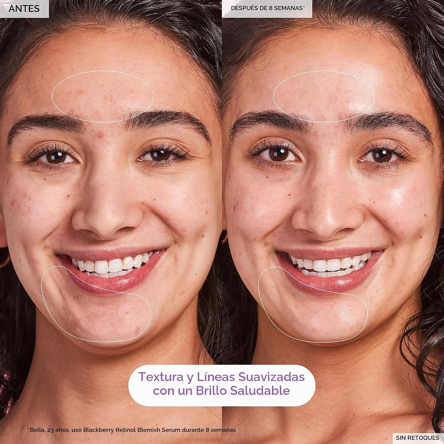 BRILLO GLOW RECIPE SUERO SUAVE DE RETINOL DE MORA, SUERO NOCTURNO DE RETINOL COREANO PARA PIELES SENSIBLES, TRIPLE - 3