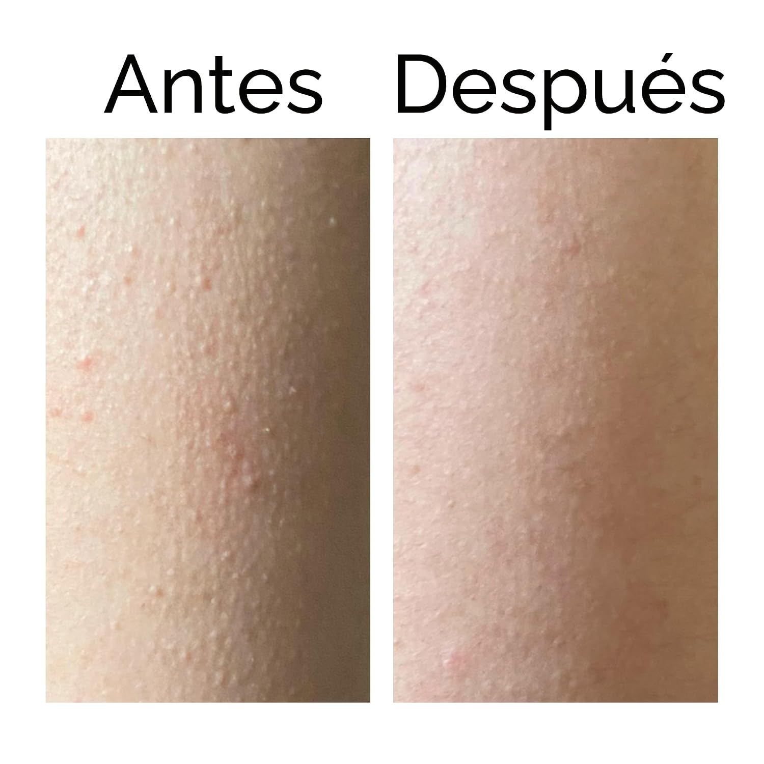 THE INKEY LIST - BÁLSAMO EXFOLIANTE DE ÁCIDO GLICÓLICO PARA EL CUERPO 45G, MÚLTIPLES PREOCUPACIONES, UNA SOLUCIÓN - 7
