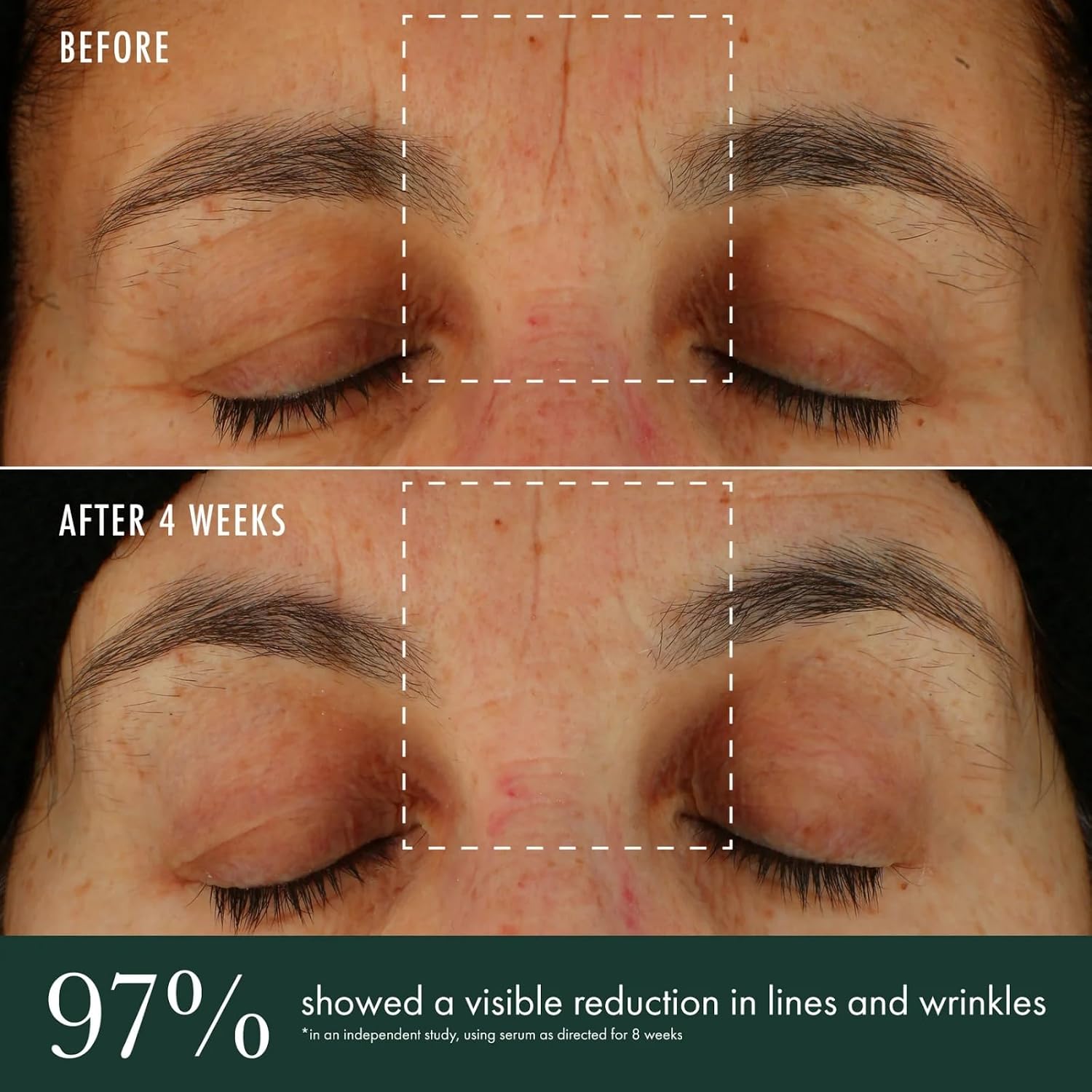 RÉVIVE SUERO ILUMINADOR - CUIDADO DE LA PIEL CON VITAMINA C, NIACINAMIDA Y PÉPTIDO DE BIORRENOVACIÓN - UNIFICA EL TONO - 6