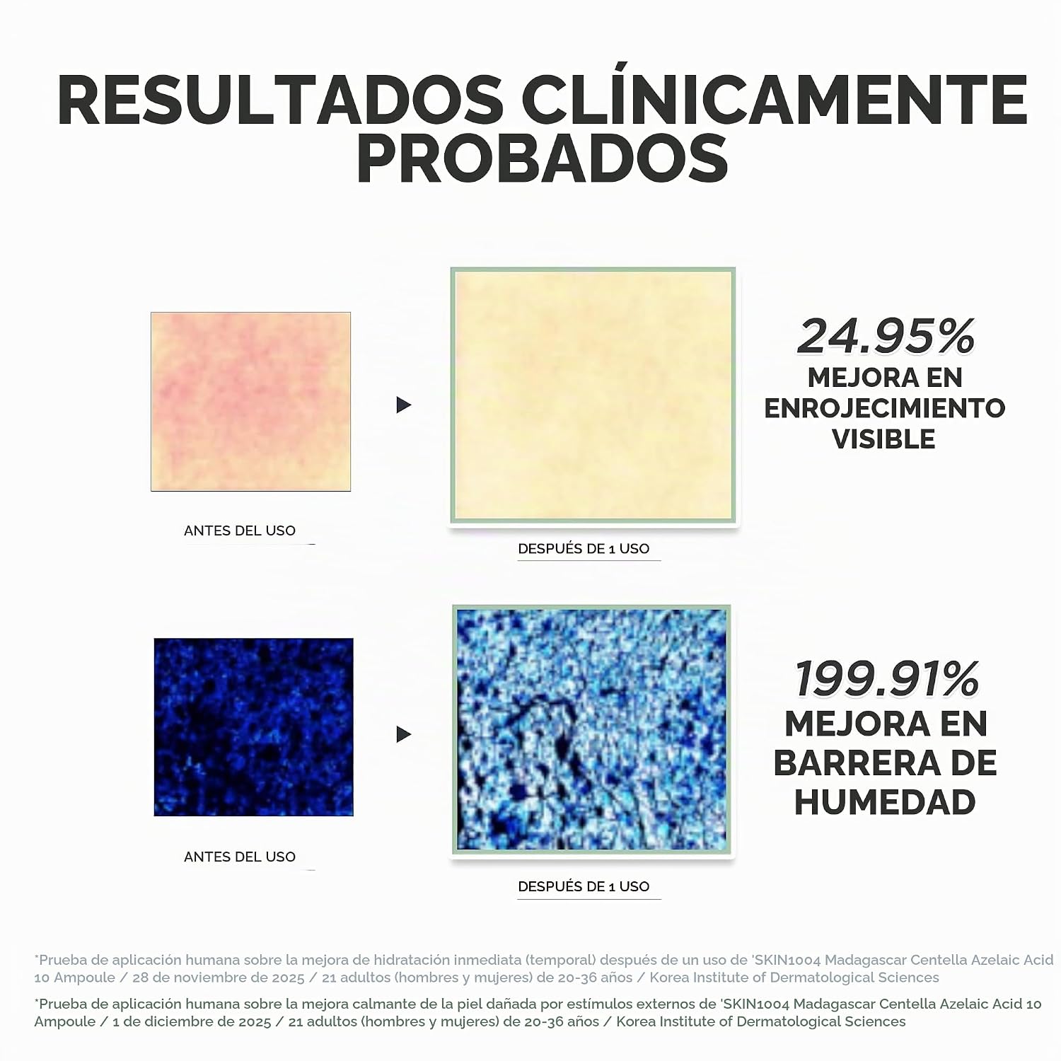 SKIN1004 AMPOLLA DE ÁCIDO AZELAICO AL 10%, SUERO FACIAL HIDRATANTE PARA PIEL PROPENSA A MANCHAS E IRRITADA, CUIDADO CALMANTE - 5
