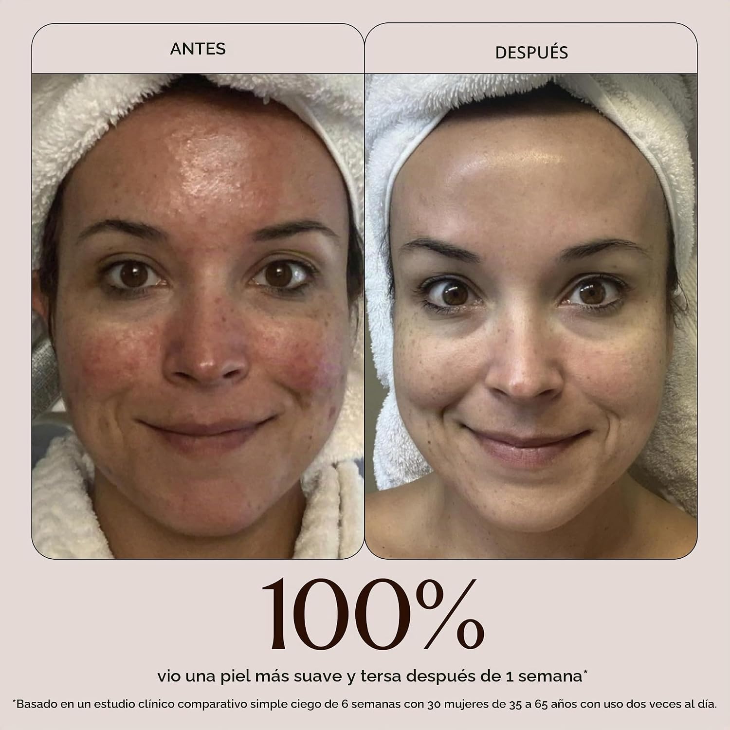 TRUE BOTANICALS CHEBULA ACTIVE SÉRUM FACIAL CONCENTRADO SUERO FACIAL ANTIENVEJECIMIENTO REDUCE LA APARIENCIA DE LÍNEAS FINAS - 4