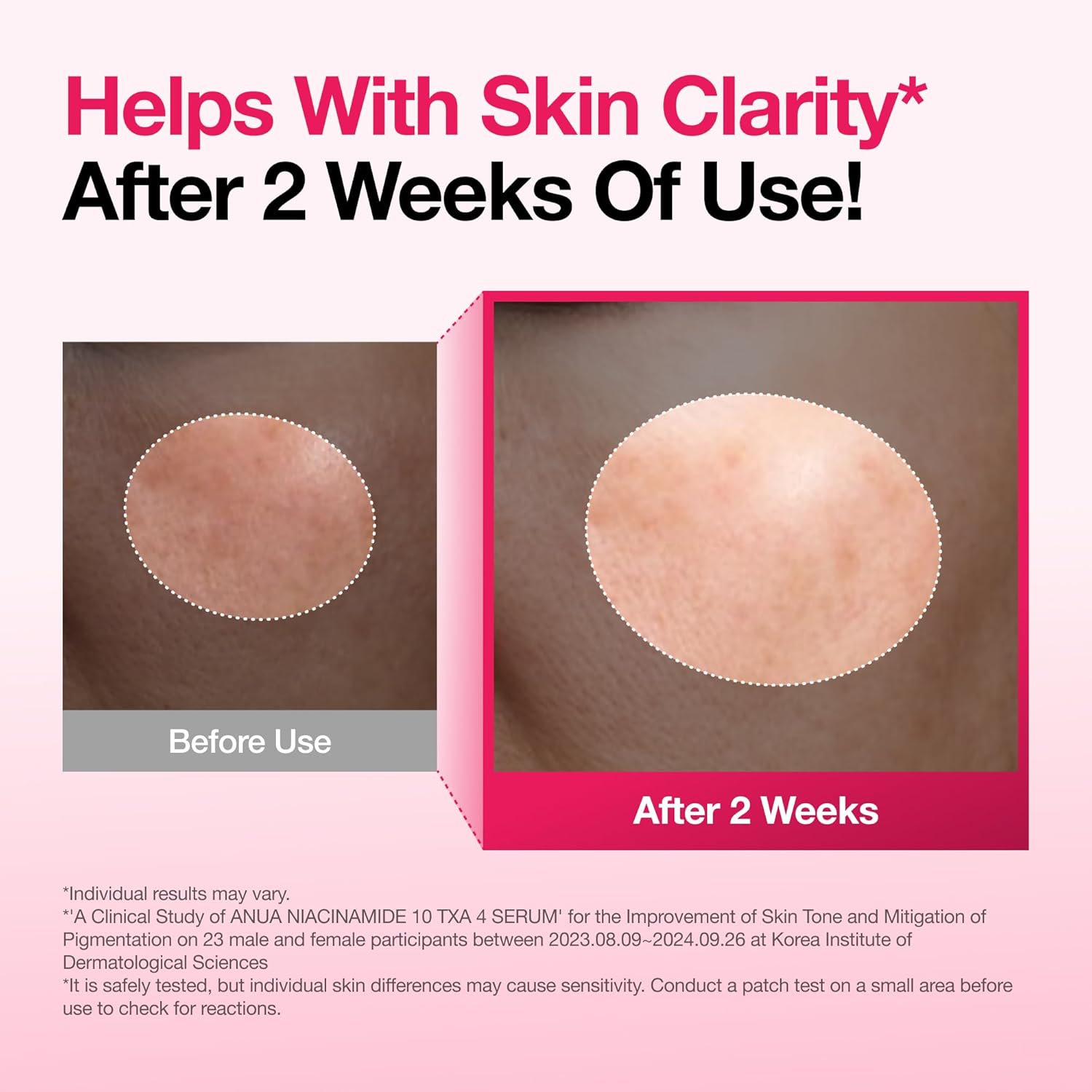 ANUA NIACINAMIDE 10 TXA 4 SÉRUM FACIAL CONCENTRADO, CUIDADO DE LA PIEL COREANO, 1.01 ONZAS LÍQUIDAS CUIDADO DE MANCHAS - 5