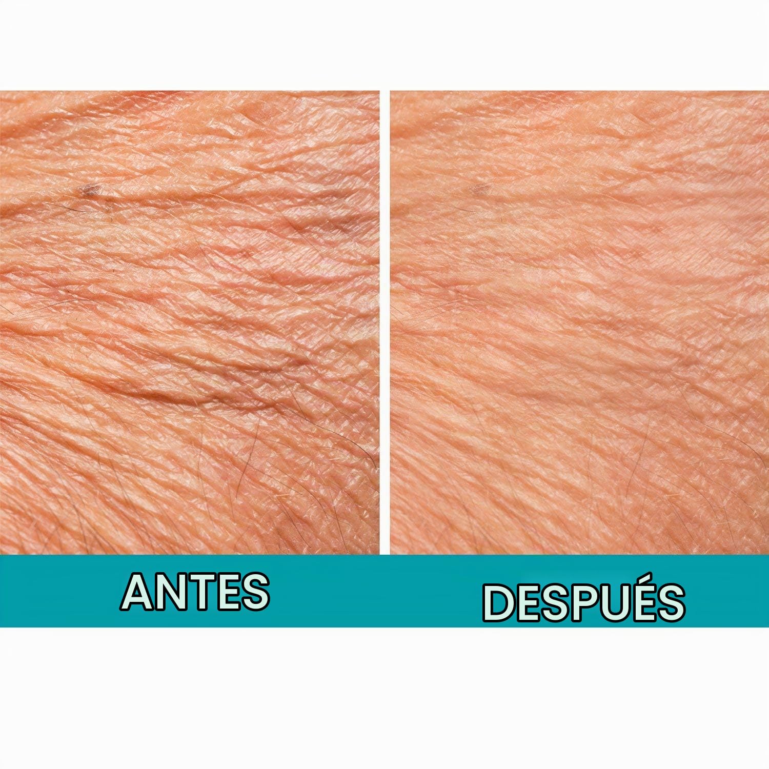 DERMACTIN CREPE BE GONE - SOUFFLE CORPORAL CLÁSICO DE 3 ONZAS, CREMA REAFIRMANTE PARA LA PIEL CREPÉ ULTRA HIDRATANTE - 7