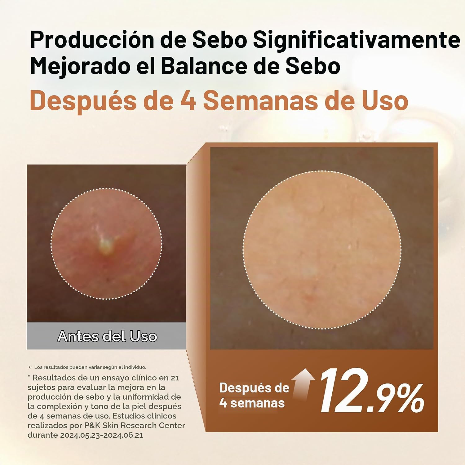 ANUA RICE 70 BRILLO GLOW MILKY TÓNICO FACIAL, PARA PIEL DE VIDRIO, AGUA DE ARROZ, NIACINAMIDA, CERAMIDAS, PANTENOL, SIN - 6