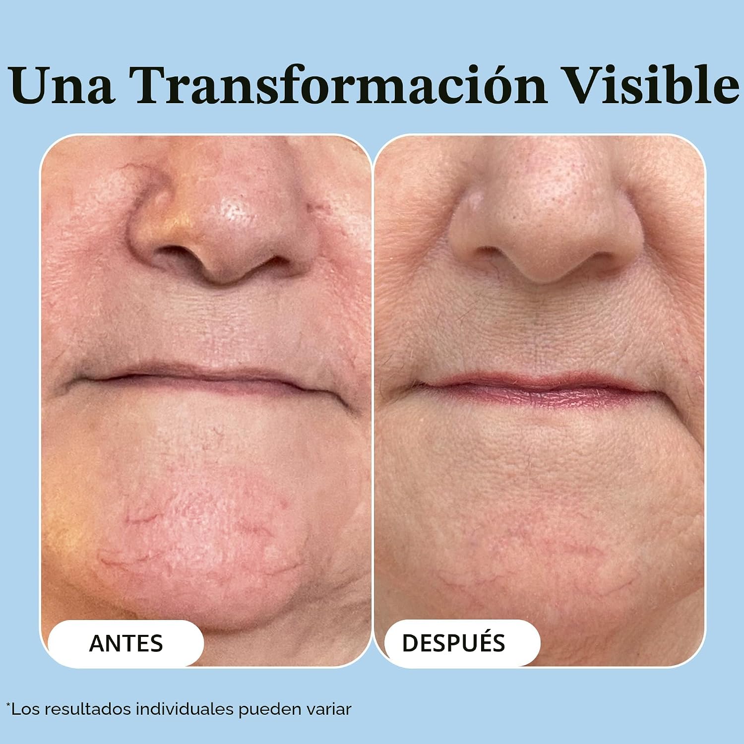 VIBRIANCE SUPER C SÉRUM FACIAL CONCENTRADO PARA PIEL MADURA - FÓRMULA VITAMÍNICA TODO EN UNO QUE HIDRATA, REAFIRMA, LEVANTA, - 5