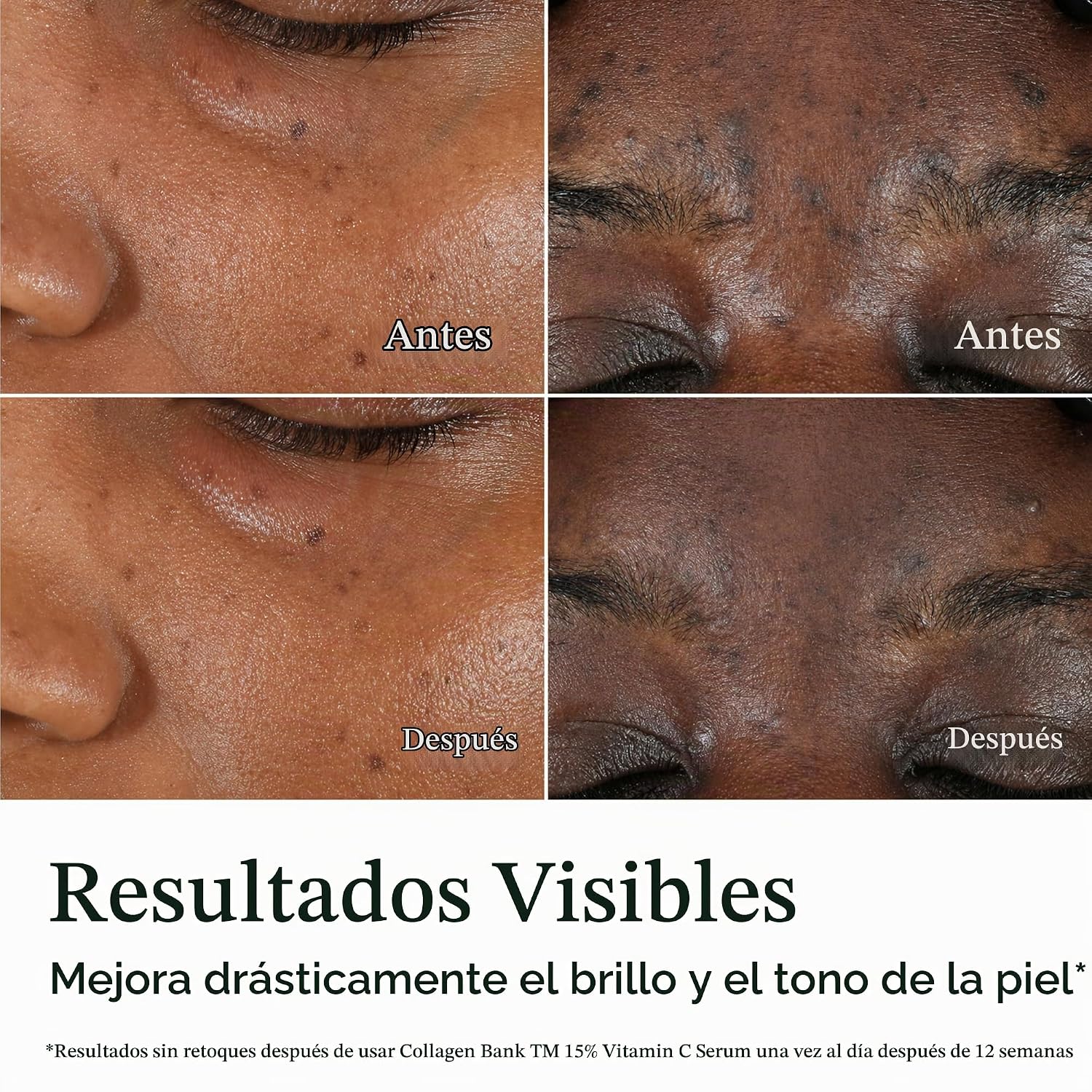 NEUTROGENA COLLAGEN BANK SÉRUM FACIAL CON 15% DE VITAMINA C, SÉRUM DE VITAMINA C PARA EL ROSTRO QUE AYUDA A CONSTRUIR - 5