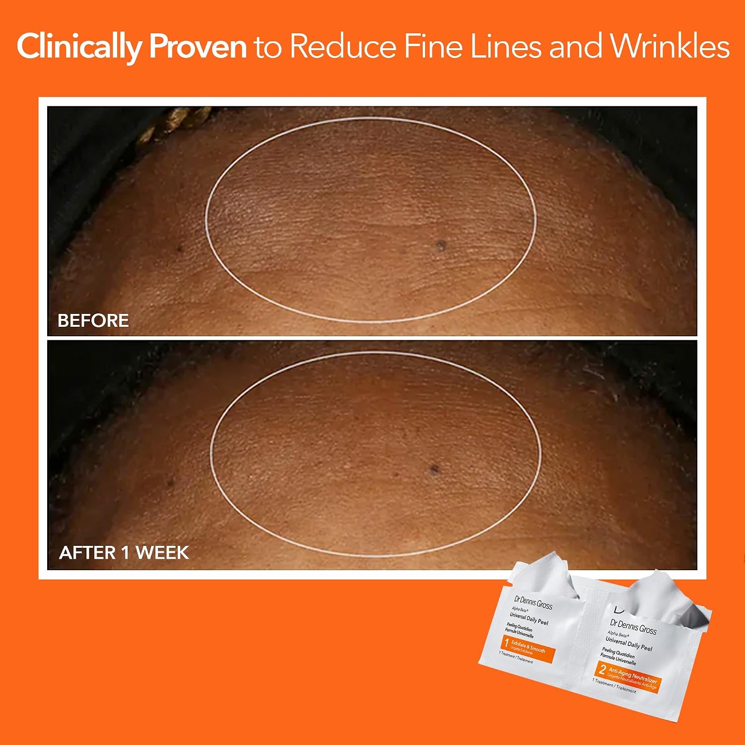 DR DENNIS GROSS ALPHA BETA UNIVERSAL EXFOLIATING DAILY PEEL - PAQUETE DE 5 - 6