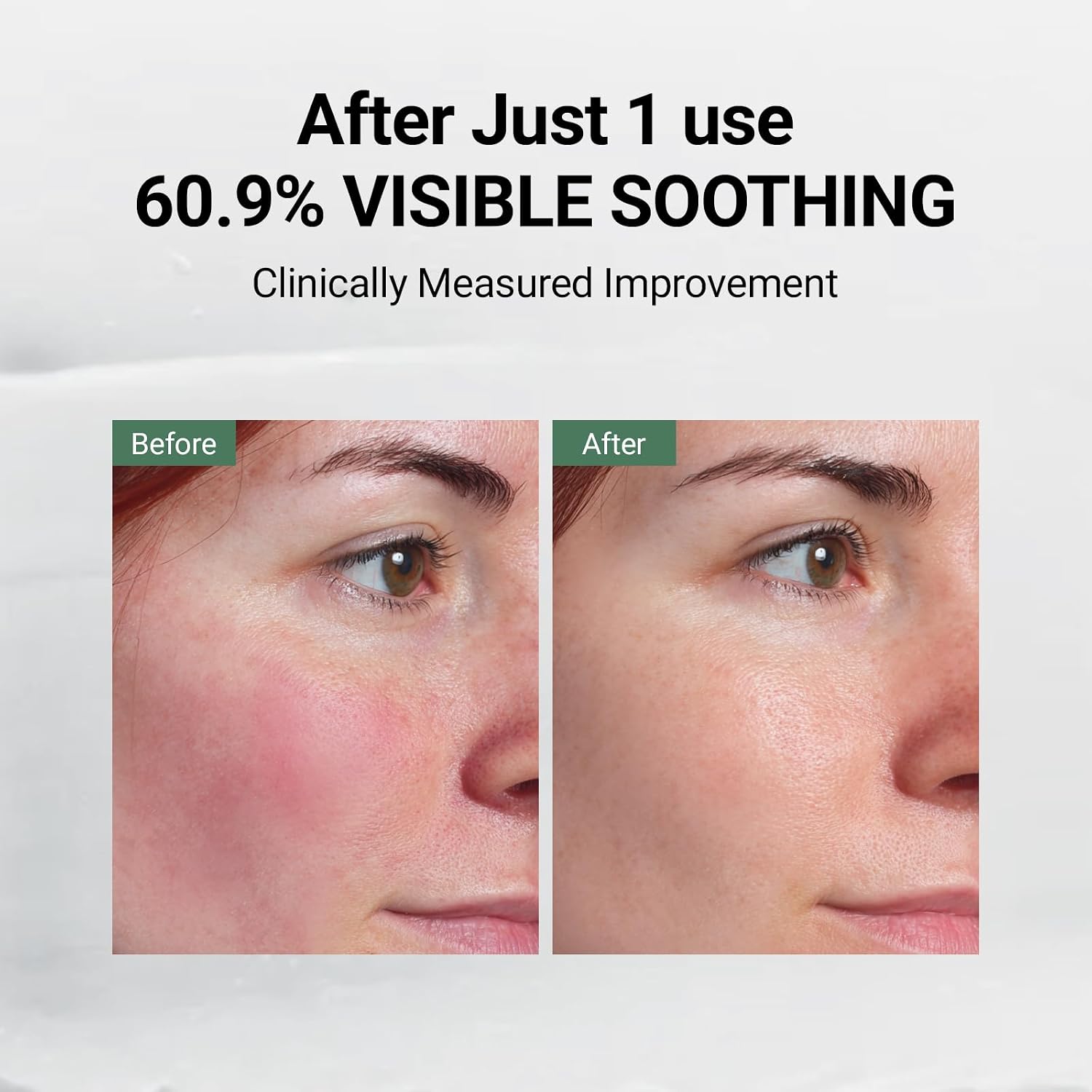 DA EFFECT - BÁLSAMO DE CUIDADO POSTERIOR 1 FL OZ , CREMA DE RECUPERACIÓN POST LÁSER PARA ENROJECIMIENTO DE LA PIEL - 4