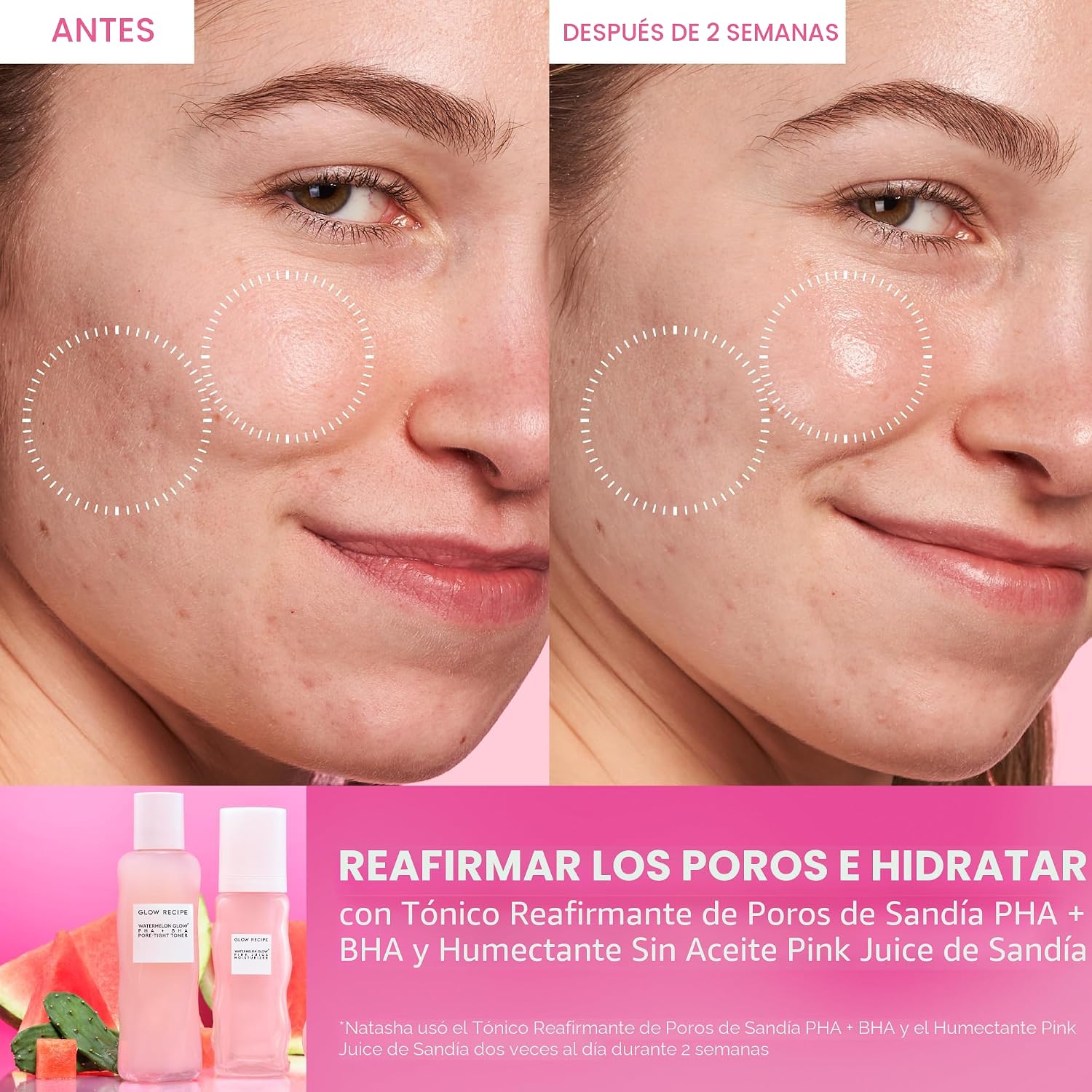 BRILLO GLOW RECIPE PINK JUICE - GEL HIDRATANTE FACIAL DE AGUA PARA MUJERES, HOMBRES Y ADOLESCENTES, ÁCIDO HIALURÓNICO - 3