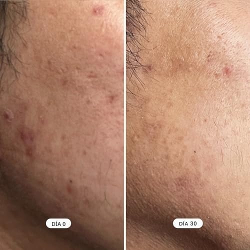 GEOLOGIE CREMA FACIAL HIDRATANTE REPARADORA DE LA PIEL FÓRMULA RENOVADORA DE RETINOL CLEAR SYSTEM PARA PIEL PROPENSA - 6