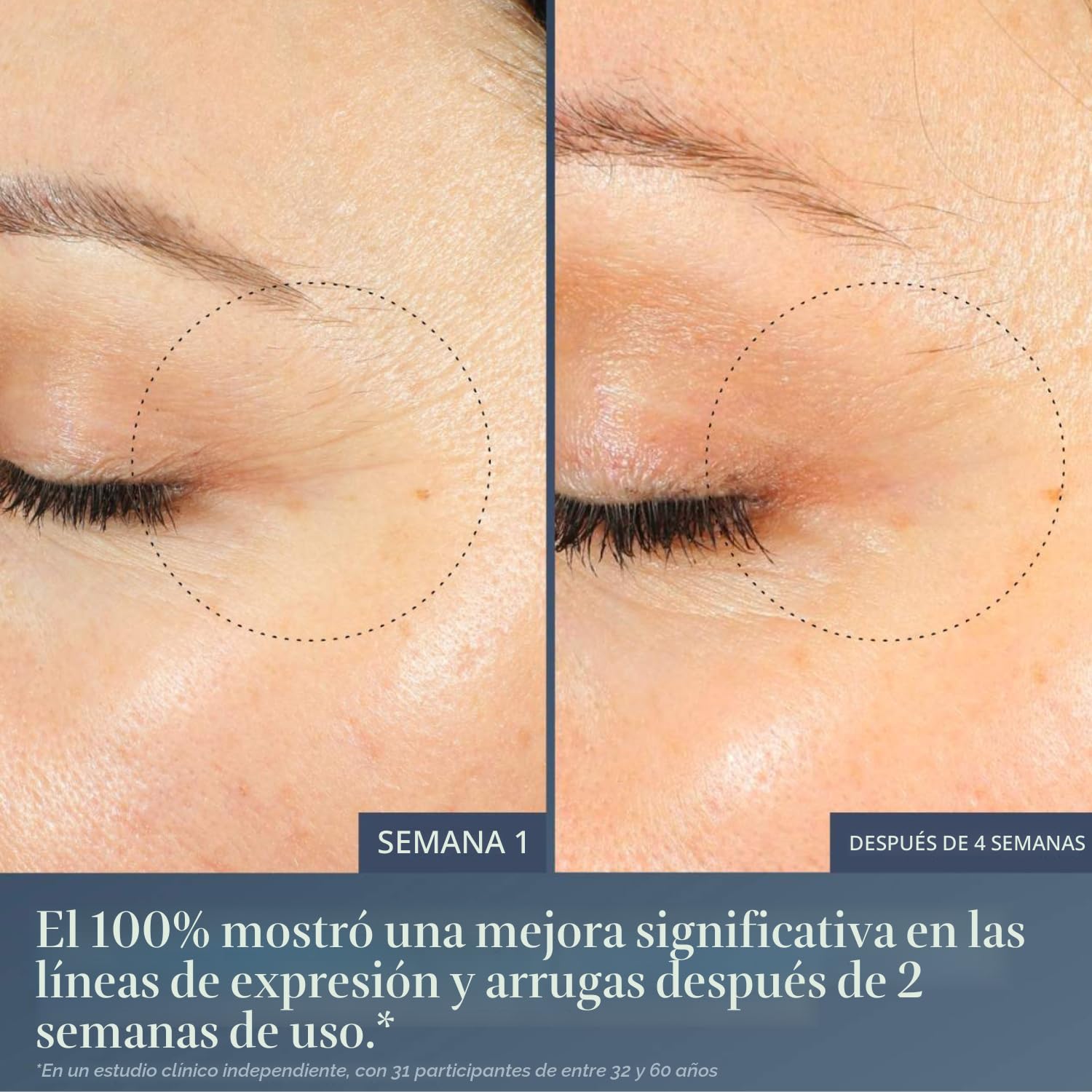 SUMMER FRIDAYS JET LAG SUERO DE OJOS NOCTURNO - TRATAMIENTO NUTRITIVO PARA EL CONTORNO DE OJOS PARA OJERAS - AYUDA - 3