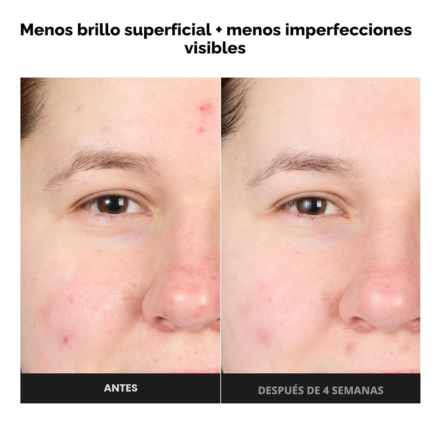 PAULA S CHOICE SKIN PERFECTING - TÓNICO DE SUERO EXFOLIANTE AVANZADO BHA AL 4%, SUAVIZANTE FACIAL CON ÁCIDO SALICÍLICO - 2