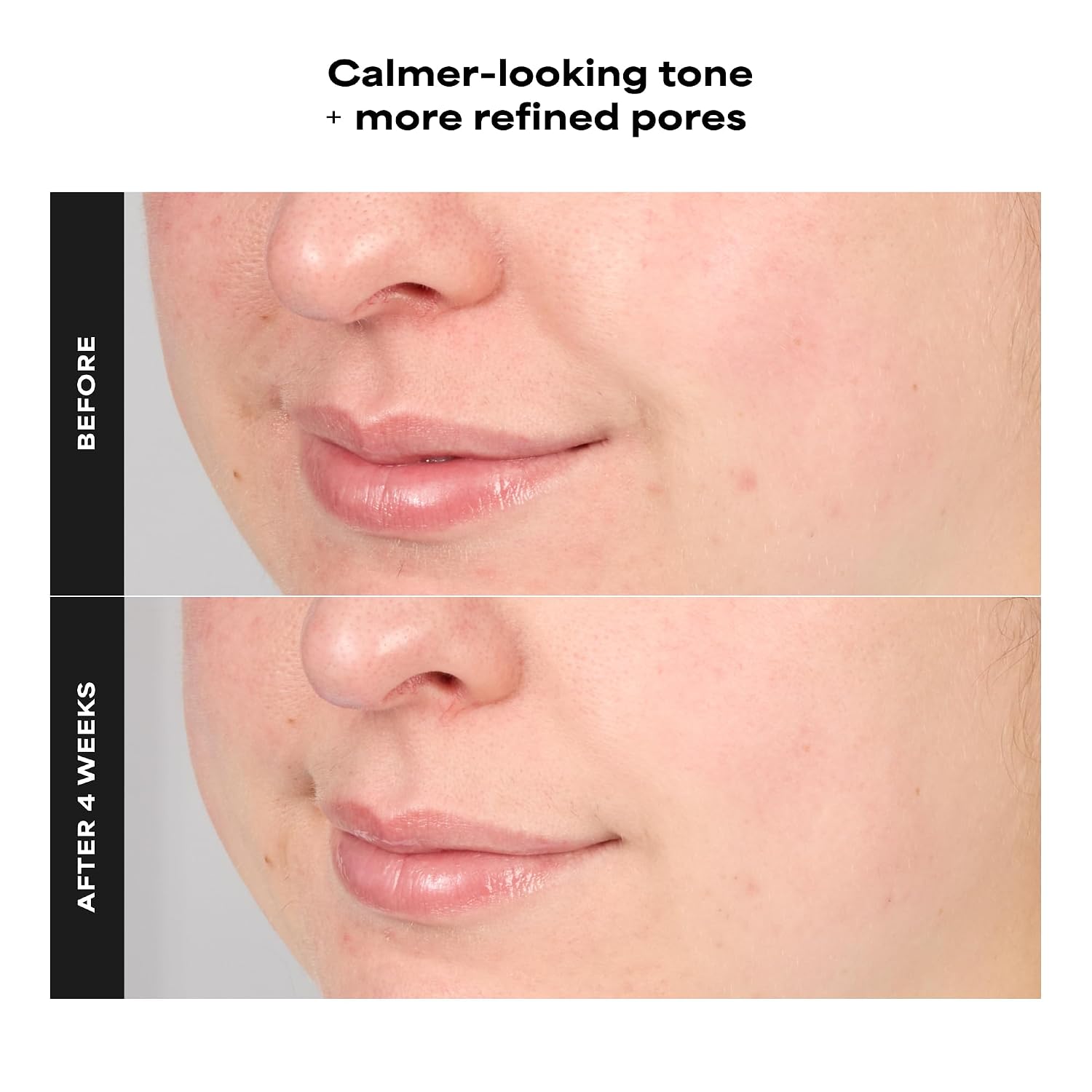 PAULA S CHOICE SKIN PERFECTING - TÓNICO DE SUERO EXFOLIANTE AVANZADO BHA AL 4%, SUAVIZANTE FACIAL CON ÁCIDO SALICÍLICO - 3