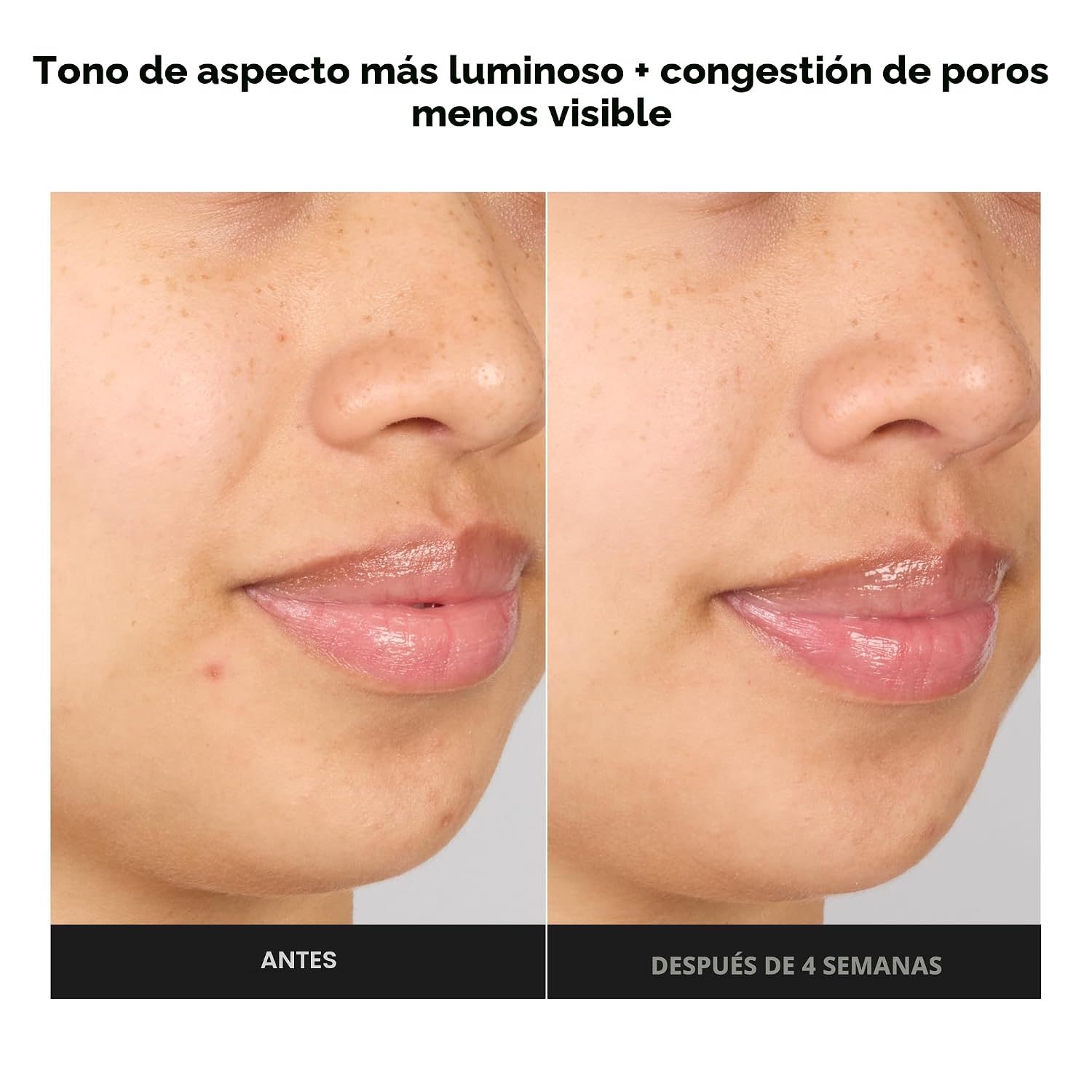 PAULA S CHOICE SKIN PERFECTING - TÓNICO DE SUERO EXFOLIANTE AVANZADO BHA AL 4%, SUAVIZANTE FACIAL CON ÁCIDO SALICÍLICO - 4