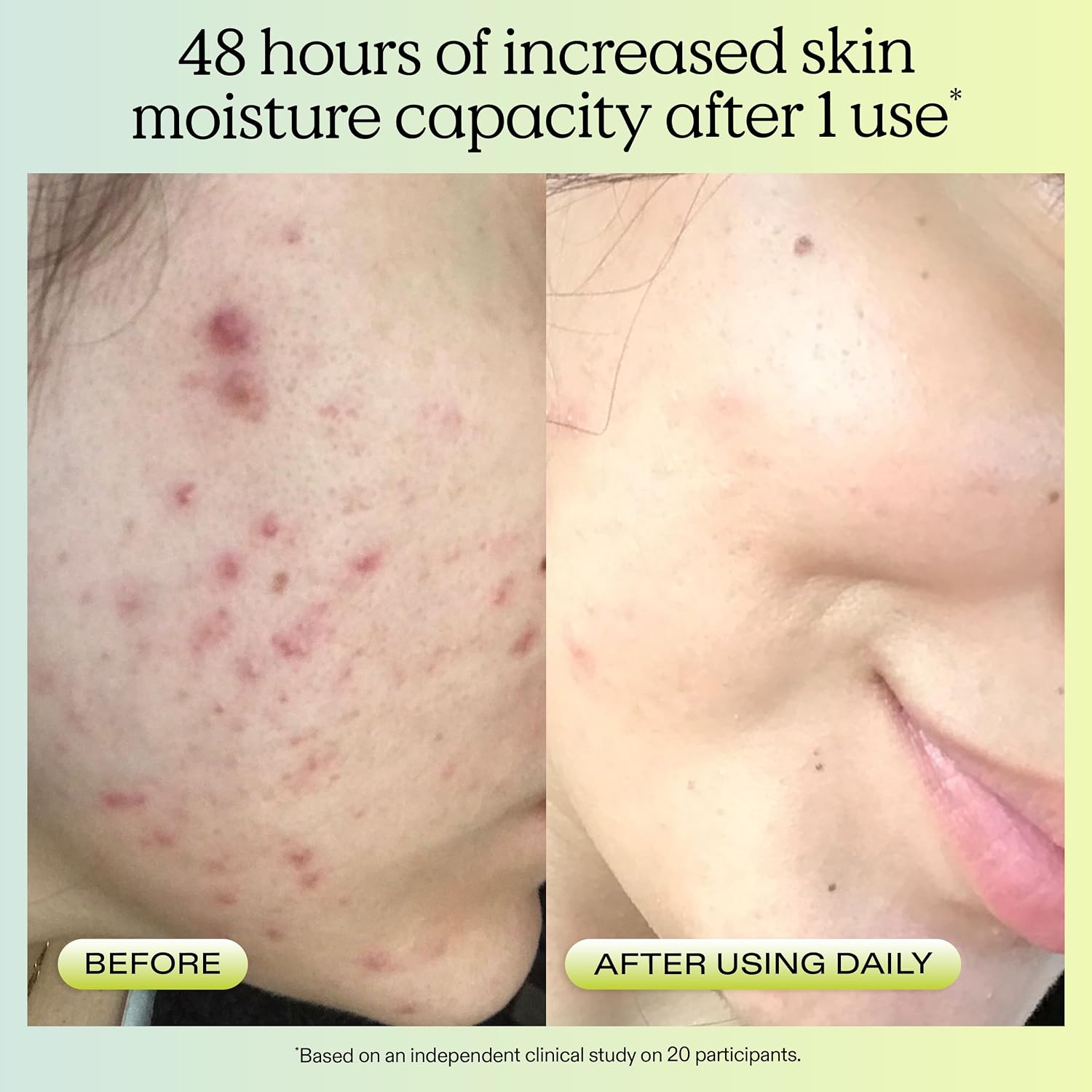 KRAVEBEAUTY MATCHA - LIMPIADOR HIDRATANTE DE CÁÑAMO PARA PIELES SECAS Y SENSIBLES, 4.1 FL OZ - 4