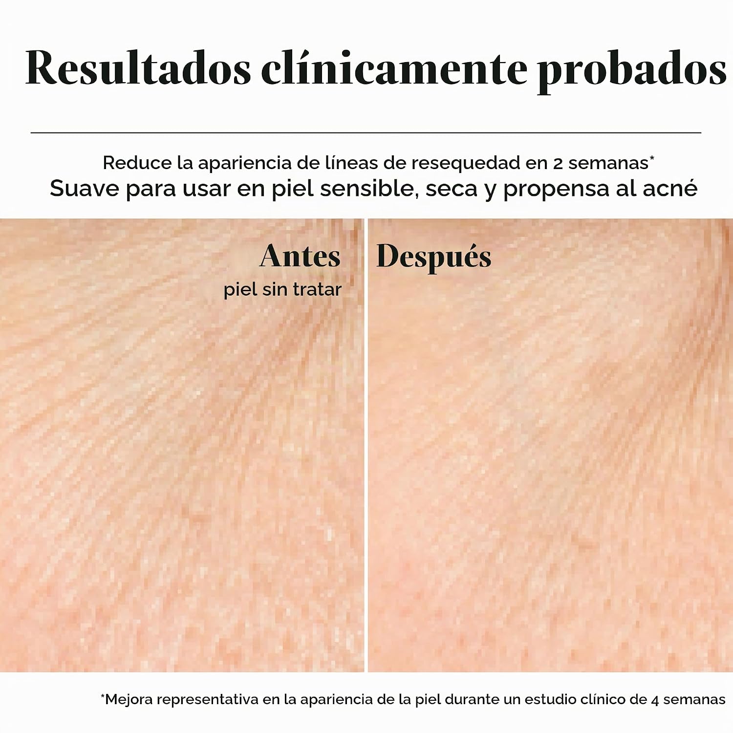 NEUTROGENA HYDRO BOOST - CREMA HIDRATANTE FACIAL EN GEL, 0.5 ONZAS LÍQUIDAS - 5