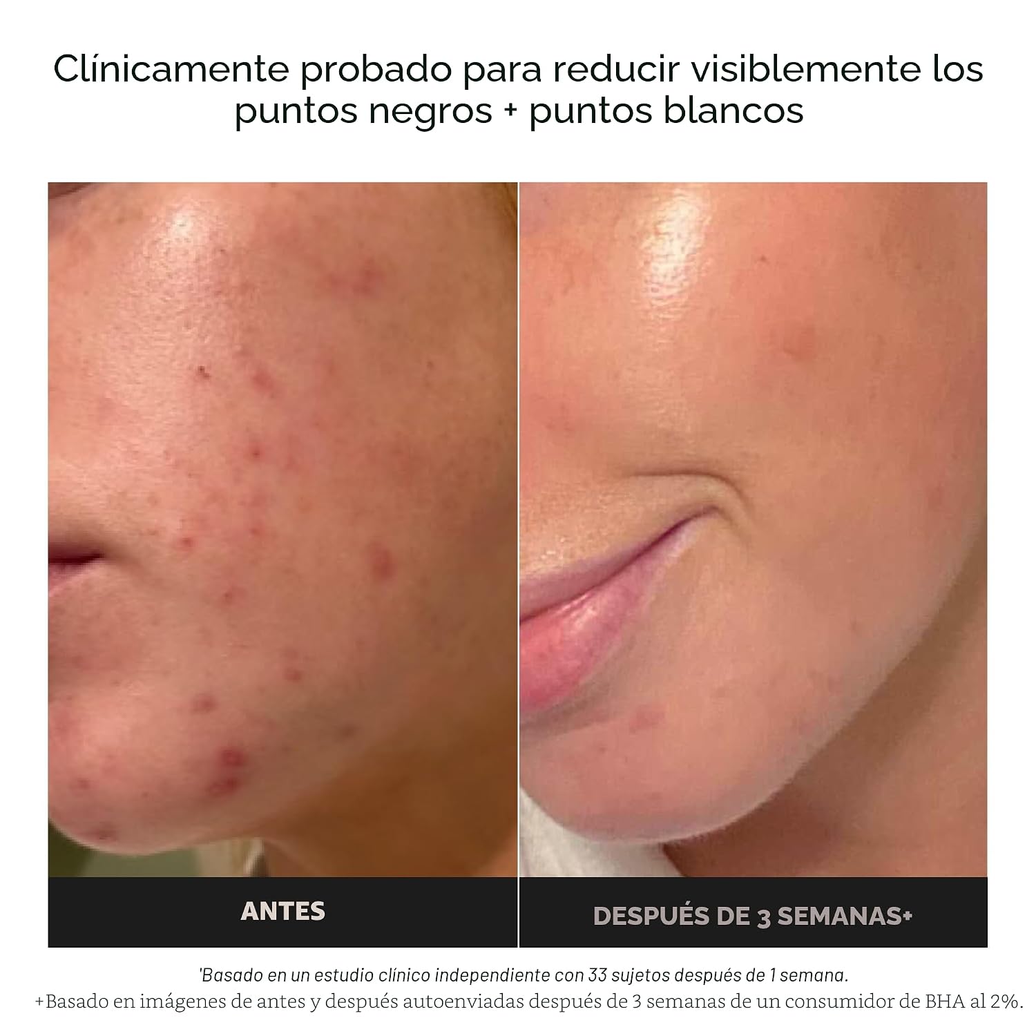 PAULA S CHOICE SKIN PERFECTING 2% BHA LIQUID EXFOLIANT - 3