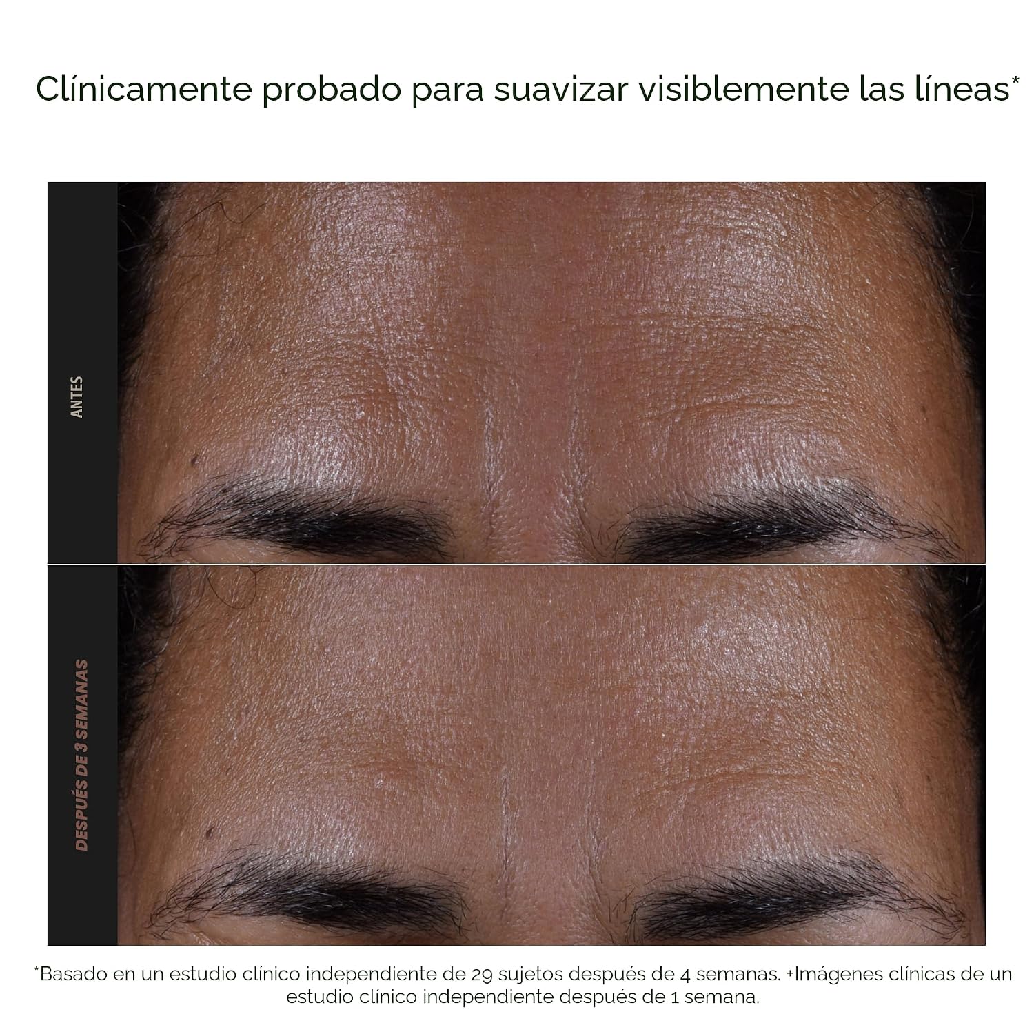PAULA S CHOICE SKIN PERFECTING 2% BHA LIQUID EXFOLIANT - 4