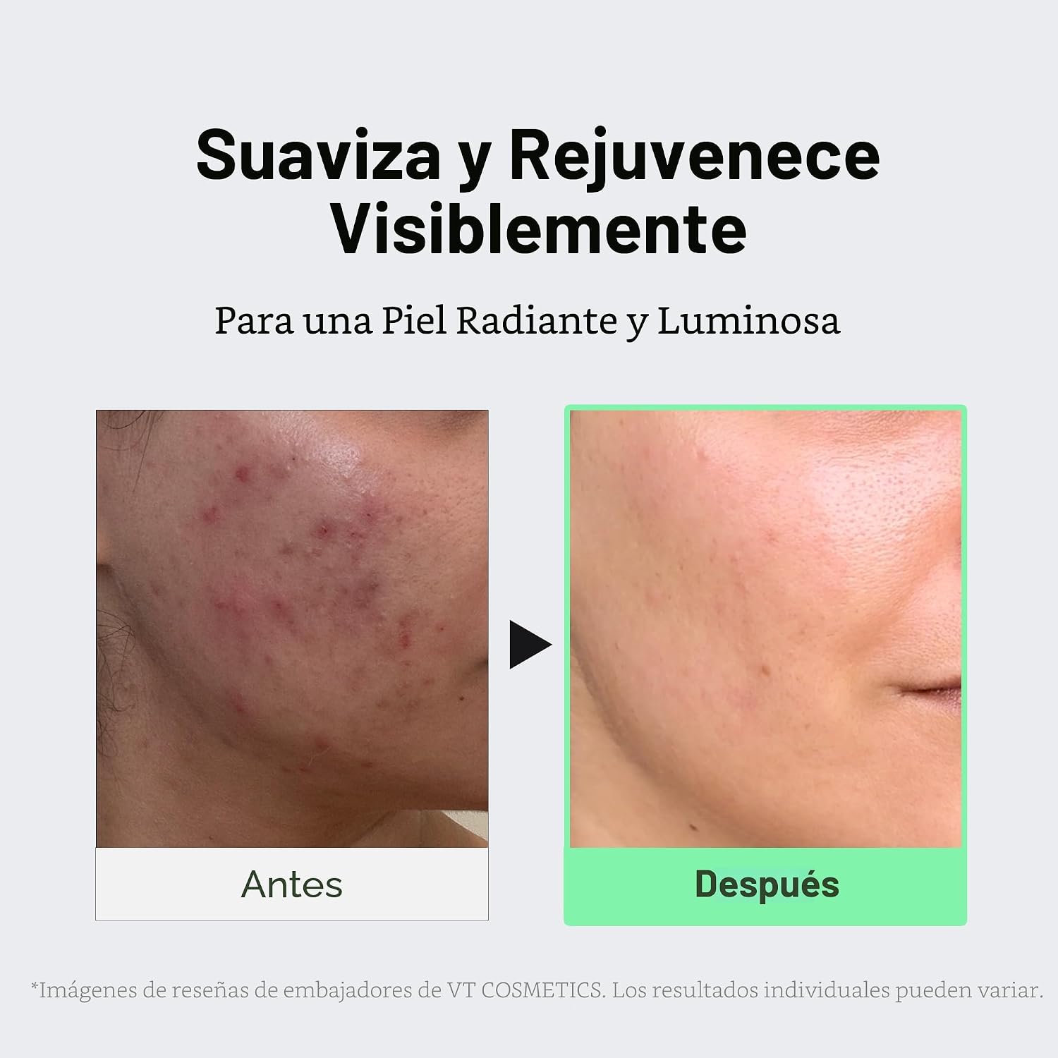 VT COSMETICS CICA REEDLE SHOT 100 SUERO DE MICROAGUJAS - 5