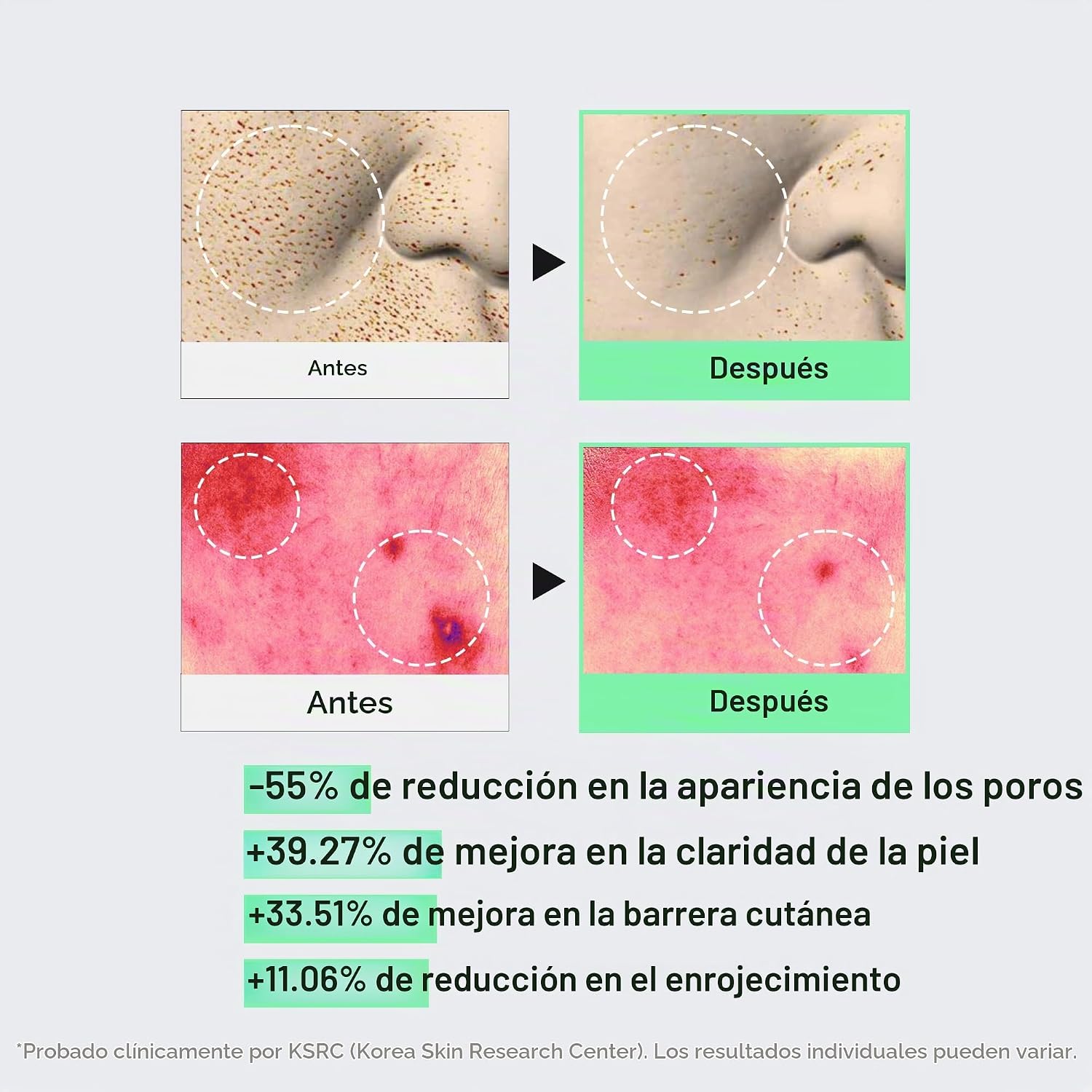 VT COSMETICS CICA REEDLE SHOT 100 SUERO DE MICROAGUJAS - 6