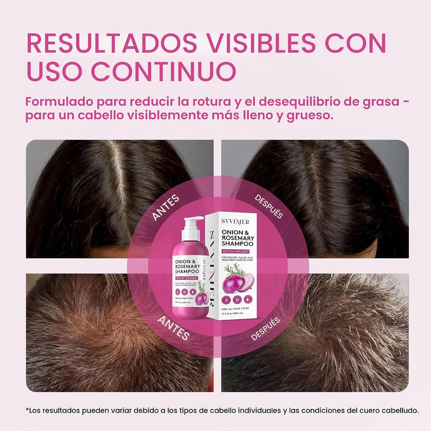 CHAMPĂ DE CEBOLLA Y ROMERO Y BIOTINA, CHAMPĂ PARA EL CRECIMIENTO DEL CABELLO PARA PĂRDIDA Y ADELGAZAMIENTO DEL CABELLO, - 4