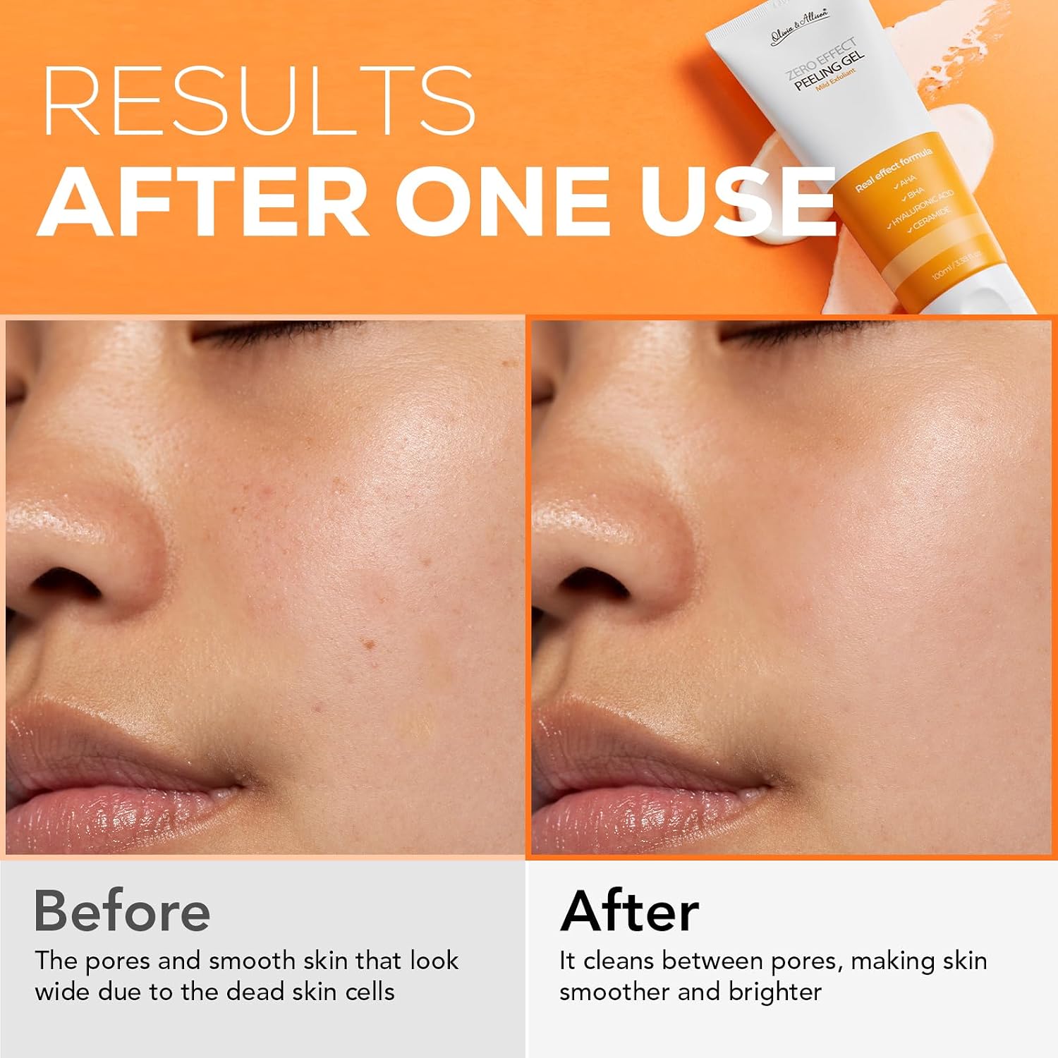 OLIVIA Y ALLISON ZERO EFFECT PEELING GEL 3.38FL OZ 100ML NATURAL BHA AHA GEL EXFOLIANTE DE CERAMIDA - 5