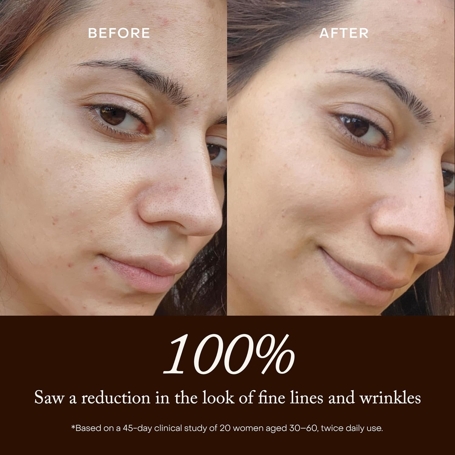 TRUE BOTANICALS RENEW PURE RADIANCE ACEITE NUTRIENTE ACEITE FACIAL ANTIENVEJECIMIENTO CON ROSA MOSQUETA REDUCE LA APARIENCIA - 4