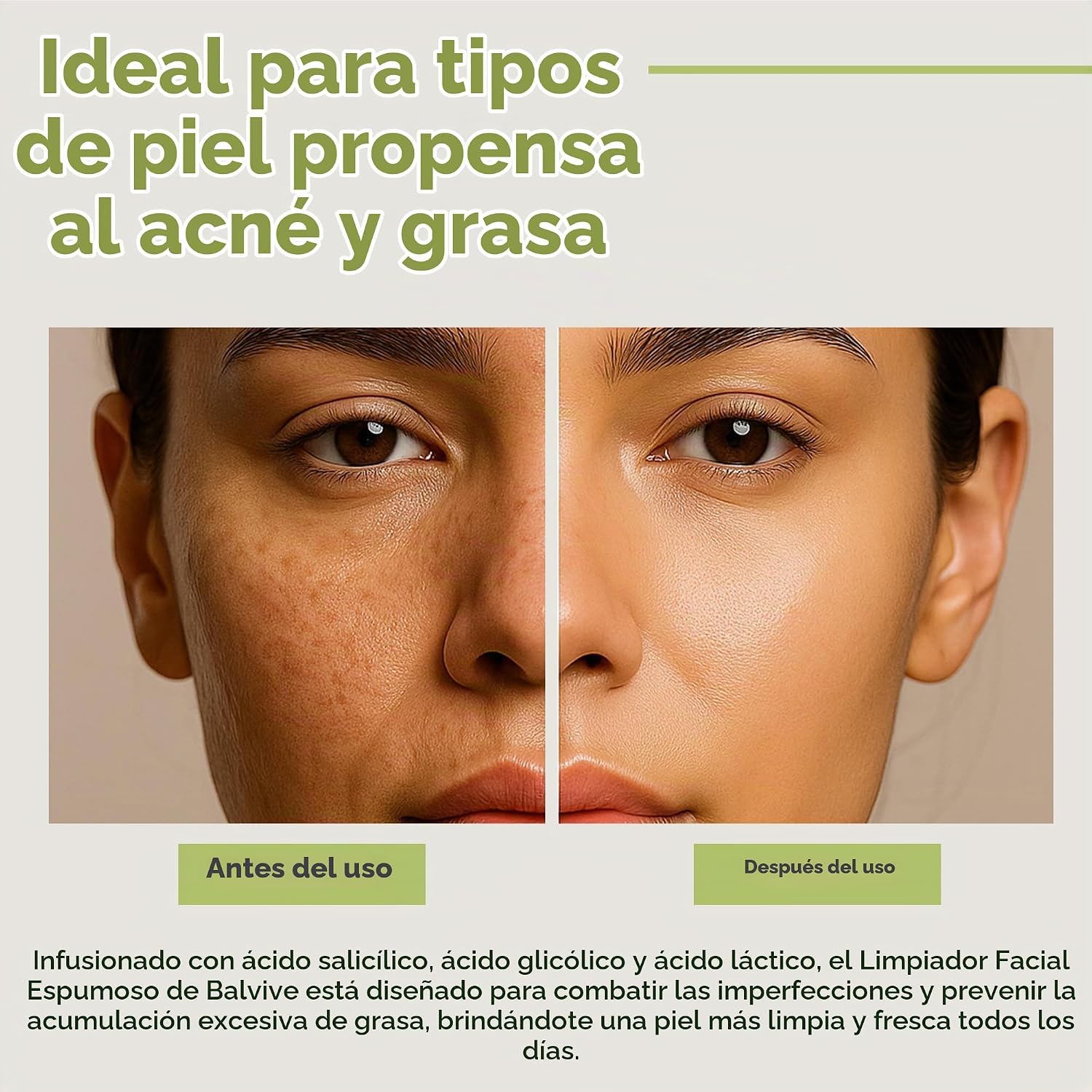 LIMPIADOR FACIAL ESPUMOSO CON ÁCIDO SALICÍLICO, ÁCIDO GLICÓLICO, ÁCIDO LÁCTICO Y EXTRACTO DE TÉ VERDE, LAVADO FACIAL - 5